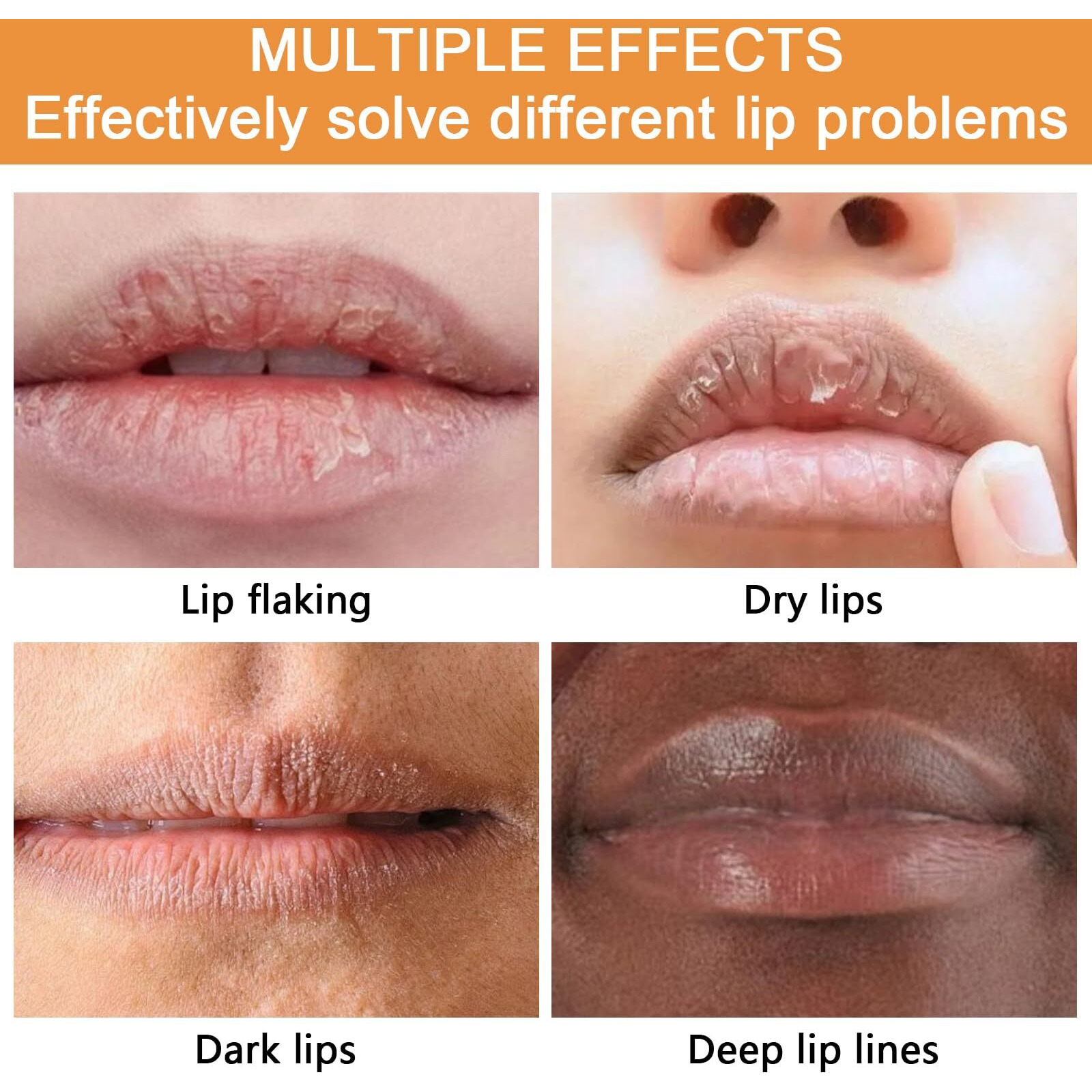 Jutqut 2Pcs Turmeric Lip Balm For Dark Lips With Turmeric Oil, Dark Lips Treatment For Smokers, Help Fade Lip Discoloration, Long-Lasting Moisturizing Lip, Cracked, And Dull Lip, Natural Balm5G/0.17Oz