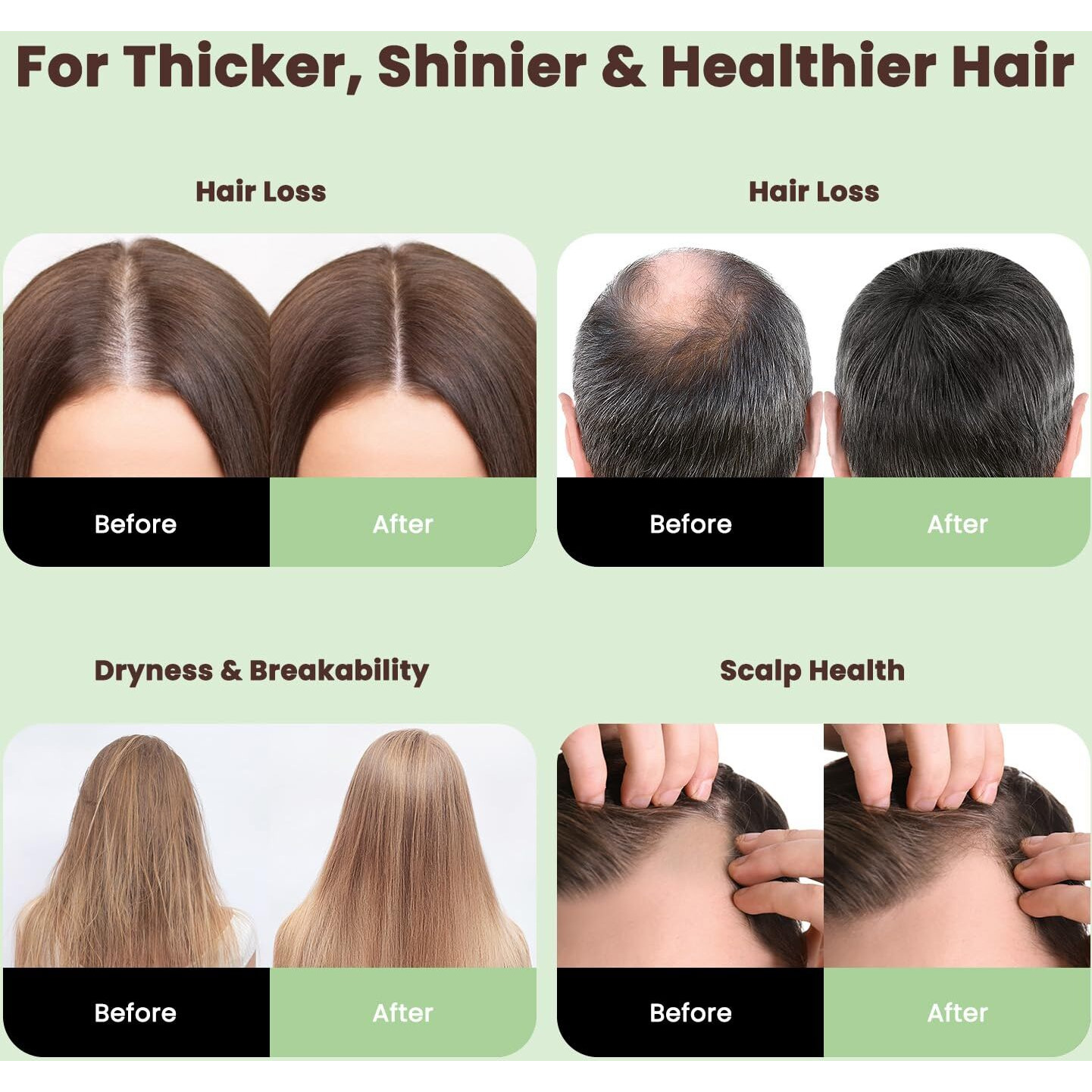 Batana Oil For Hair Growth, Unrefined Pure Hair Growth Oil From Honduras, 100% Authentic And Organic Approved By Dr. Sebi, Daily Use For Hair And Scalp Care, For All Hair Type, 4 Fl Oz