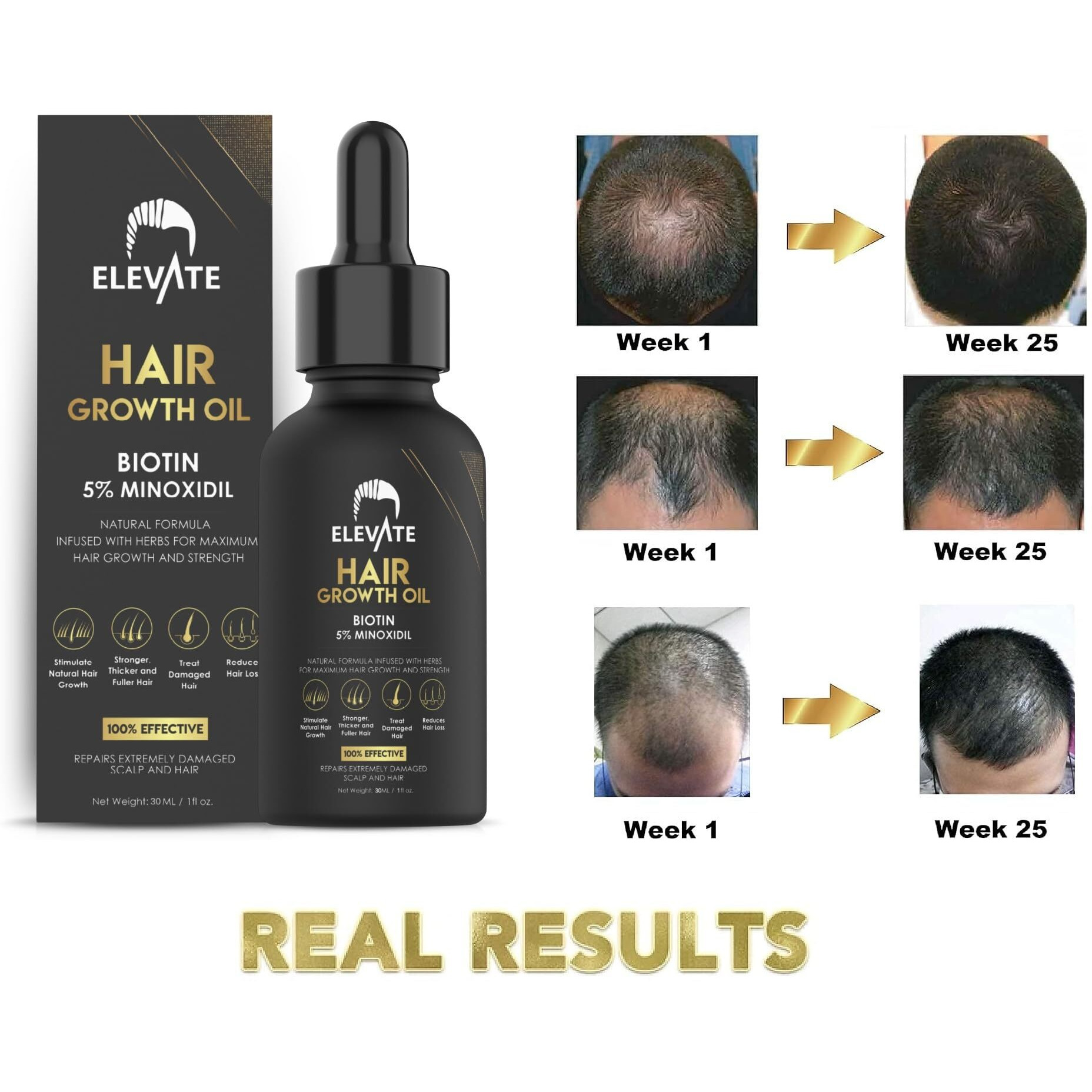 Elevate Hair Growth Oil - Biotin Serum & 5% Minoxidil Treatment For Stronger Thicker Longer Hair - Natural Hair Growth Thickening Treatment - Stop Thinning & Hair Loss For Men & Women 1Oz