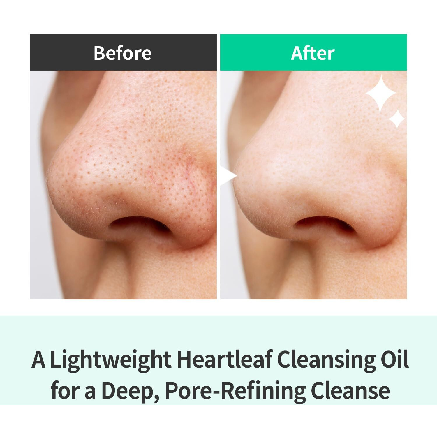 Ootd Deep Cleansing Oil Makeup Remover For Face, Heartleaf Bha Tea Tree Mild Soothing Pore Tightening Blackhead Care. Heartleaf Pore Zero Cleansing Oil 200Ml 6.76 Fl. Oz.
