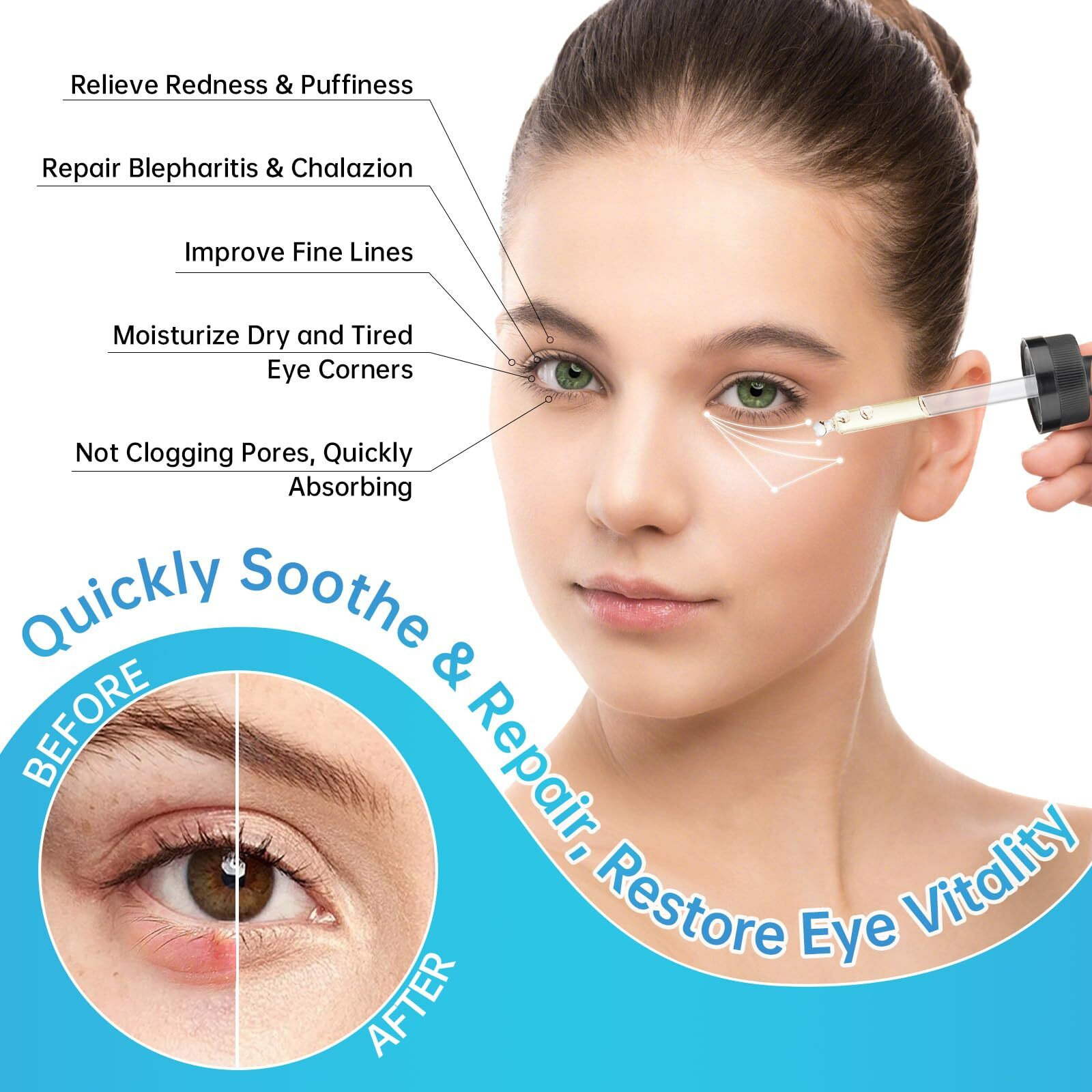 Eye Serum For Chalazion & Blepharitis Treatment, 30Ml Chalazion Remover For Eyelid Treatment, Blepharitis Eyelid Serum With Avocado Oil, Sea Buckthorn Oil & Caffeine, Relieve Puffiness And Eye Fatigue