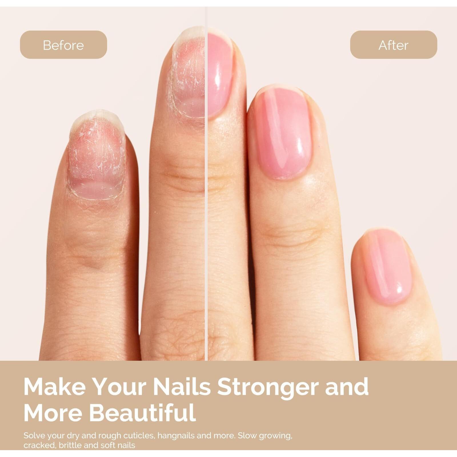 Melodysusie 15Ml Cuticle Oil,Nail Strengthener With Jojobal & Vitamin E,Nail Growth That Repairs Cuticles & Promotes,Moisturizes & Conditions Dry Skin,Rose