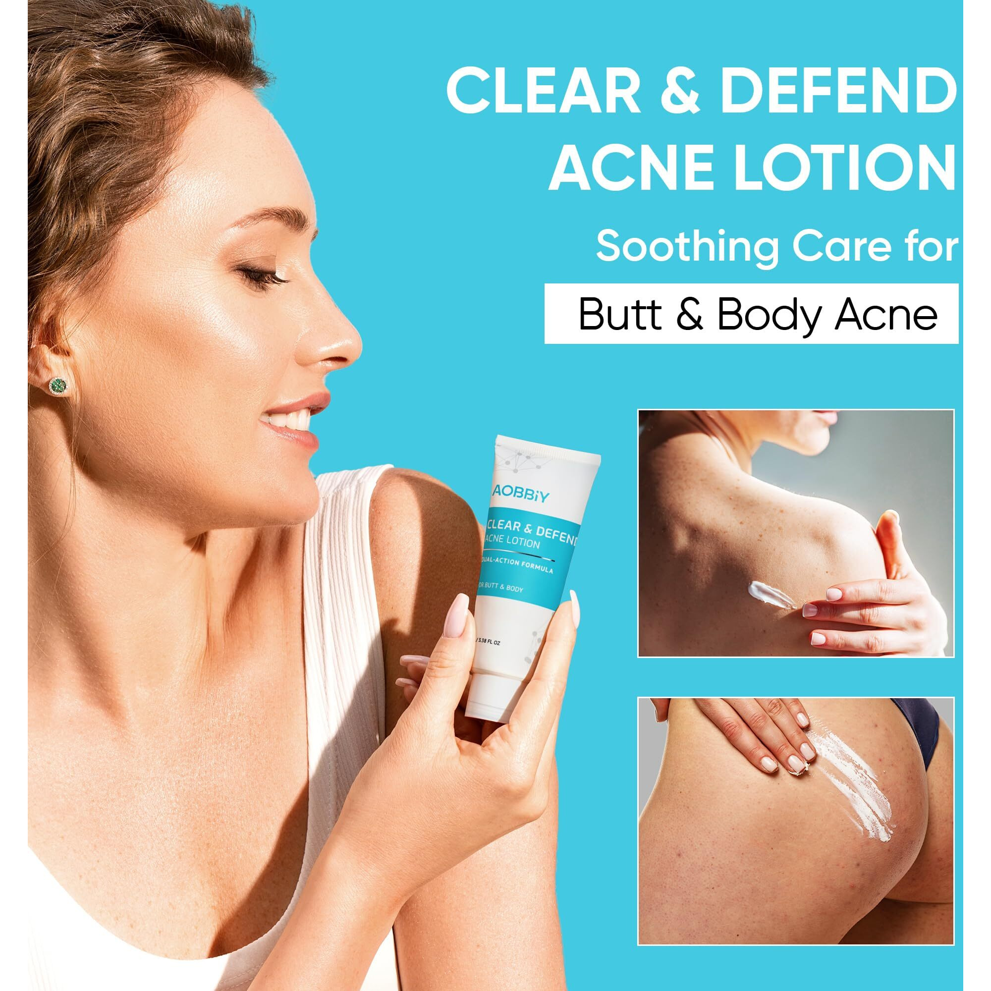 Butt Acne Clearing Treatment Cream Clears & Prevents Breakouts Fast - Gentle Body & Back Lotion For Clogged Pores, Folliculitis & Bumps, 2% Salicylic Acid & Niacinamide, Ideal For Women, Men & Teens