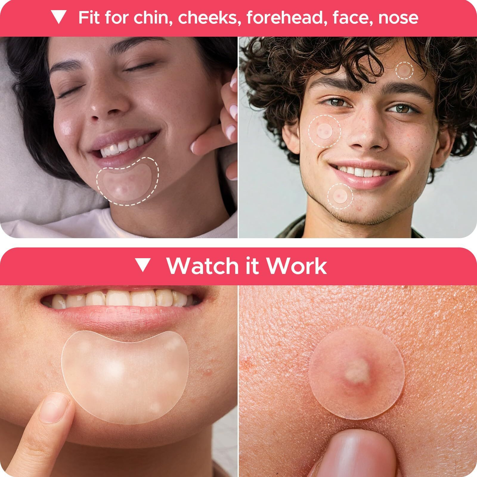 Litbear Large Pimple Patches, 5 Size 416 Count Big Acne Patches For Face, Chin, Forehead And Body, Zit Patches For Dots, Blemishes And Large Breakouts, Hydrocolloid Patch (Xl Strip, Contoured, Round)