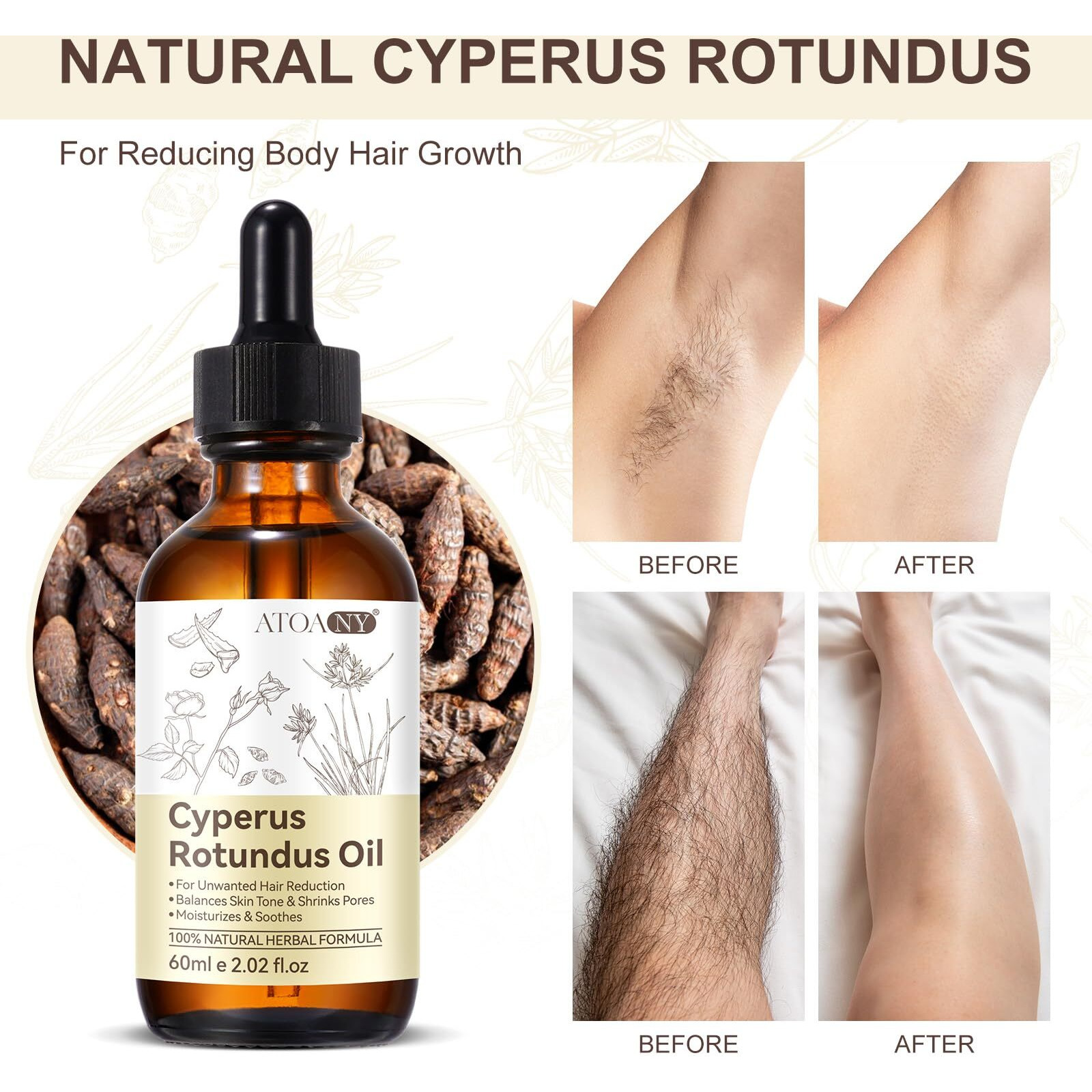 Xinszlin Cyperus Rotundus Oil For Hair Removal, Cyperus Rotundus Oil For Reducing Body Hair Growth, Smooth Skin & Hair Removal, Moisturizing & Soothing 60Ml