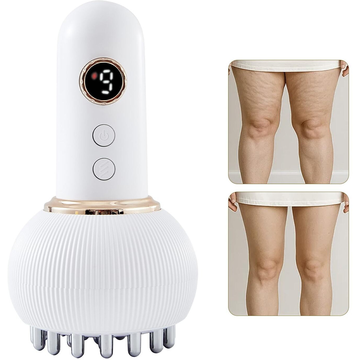 Yuonry Lymphatic Drainage Massager & Anti Cellulite Massage Tool, Helps Reduce Stretch Marks & Cellulite, For Legs, Arms & Belly, Body Sculpting Machine With Microcurrent, Light, Heat & Vibration