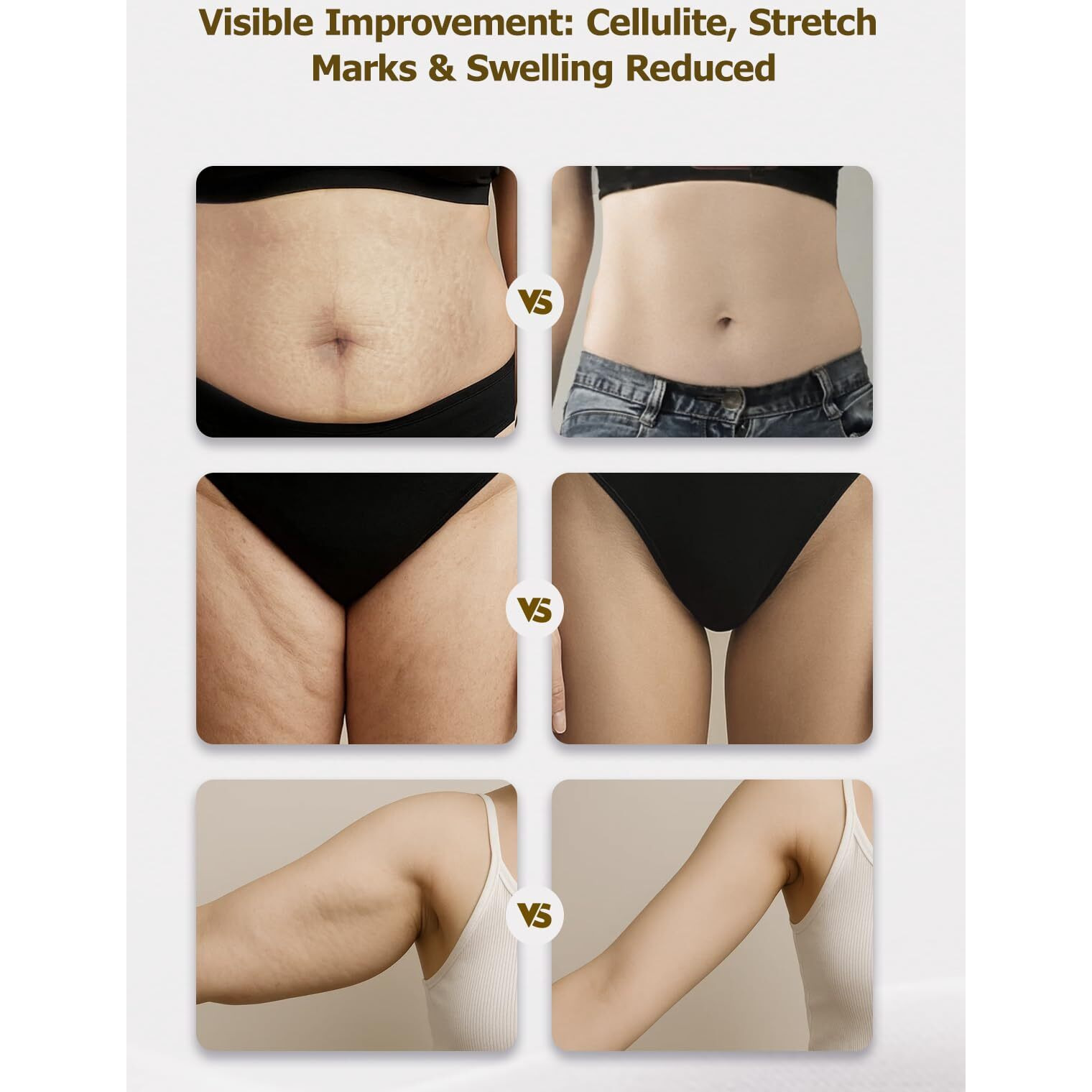 Yuonry Lymphatic Drainage Massager & Anti Cellulite Massage Tool, Helps Reduce Stretch Marks & Cellulite, For Legs, Arms & Belly, Body Sculpting Machine With Microcurrent, Light, Heat & Vibration