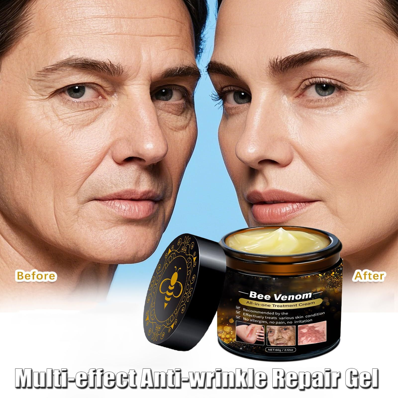 2-Pack Bee Venom Skin Repair Cream,Bee Venom Comprehensive Cream,Multi-Effect Anti-Wrinkle Repair Gel,Reduces Blemishes For Face & Body,Suitable For All Skin Types (2 X 60G)