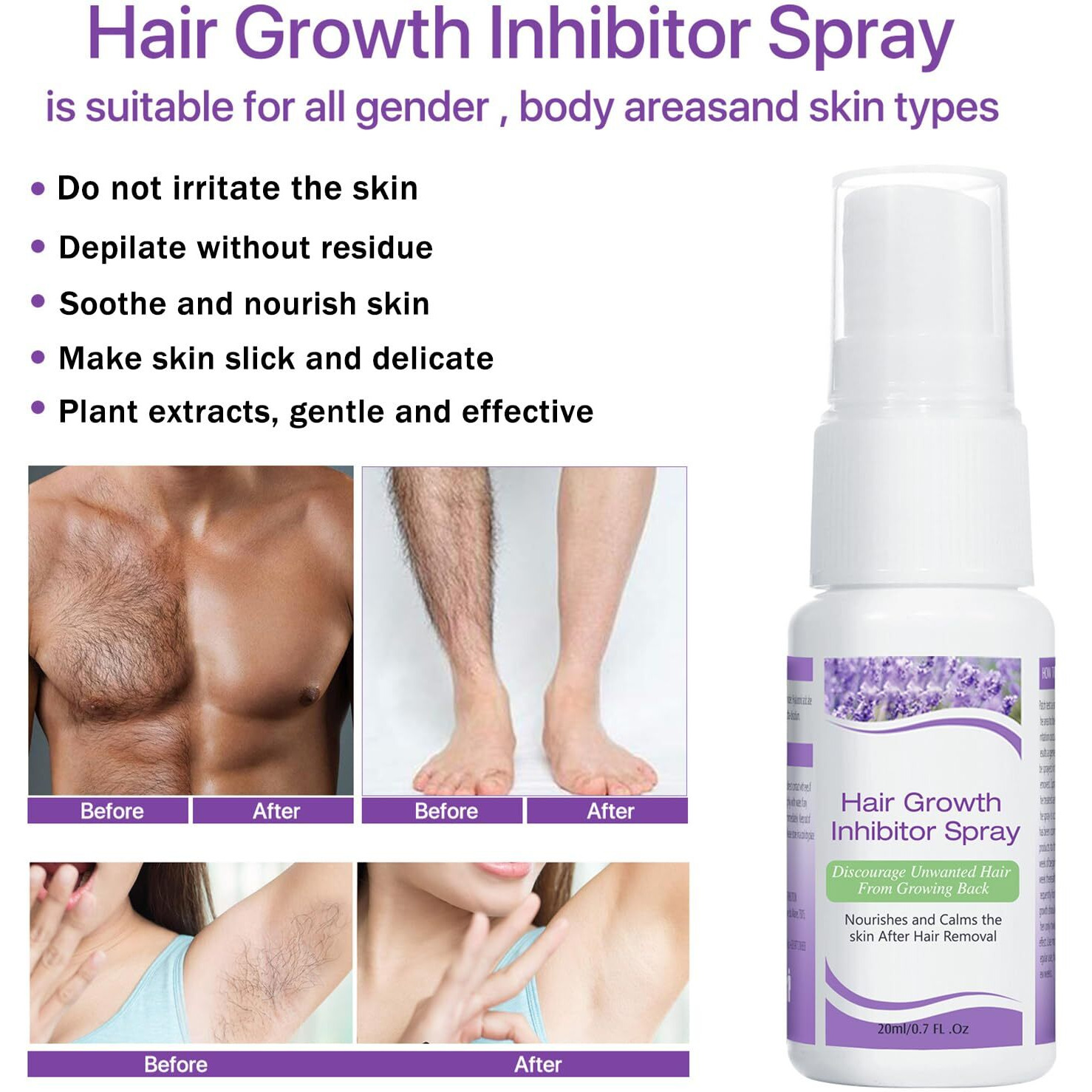 Hair Growth Inhibitor For Face, Hair Inhibitor Permanent Spray, Non-Irritating Hair Inhibitor, Permanent Hair Removal Spray For Body, Face, Underarm, Arm, Leg, Private Areas, Slows Regrowth (1)