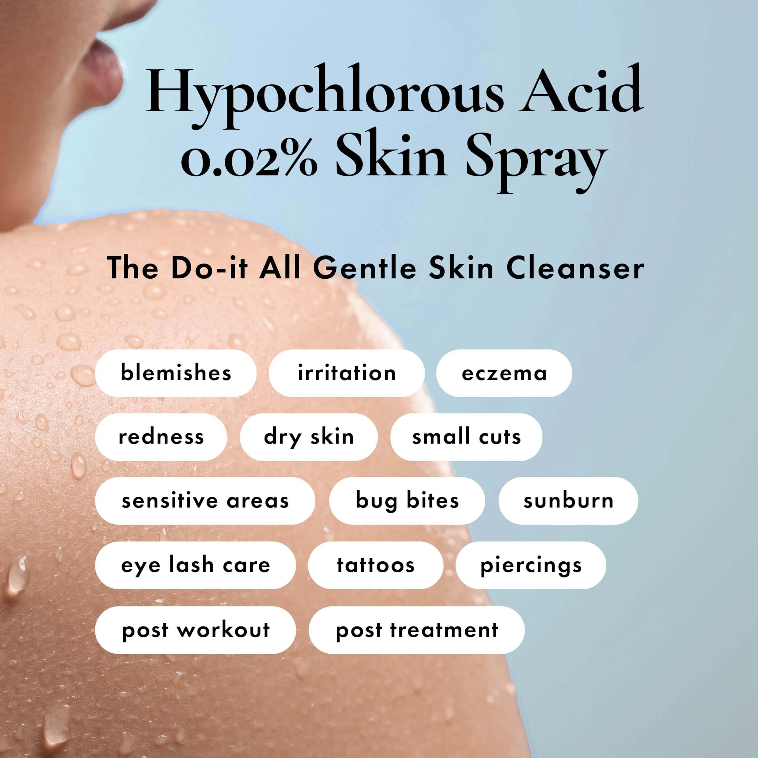 Hypochlorous Acid Spray - Hocl Spray For Face, Body & Eyelids, Gentle Daily Skin Cleanser Safe For Acne-Prone, Red Or Sensitive Skin, Non-Sting, 0.02% Hypochlorous Solution, 8 Oz