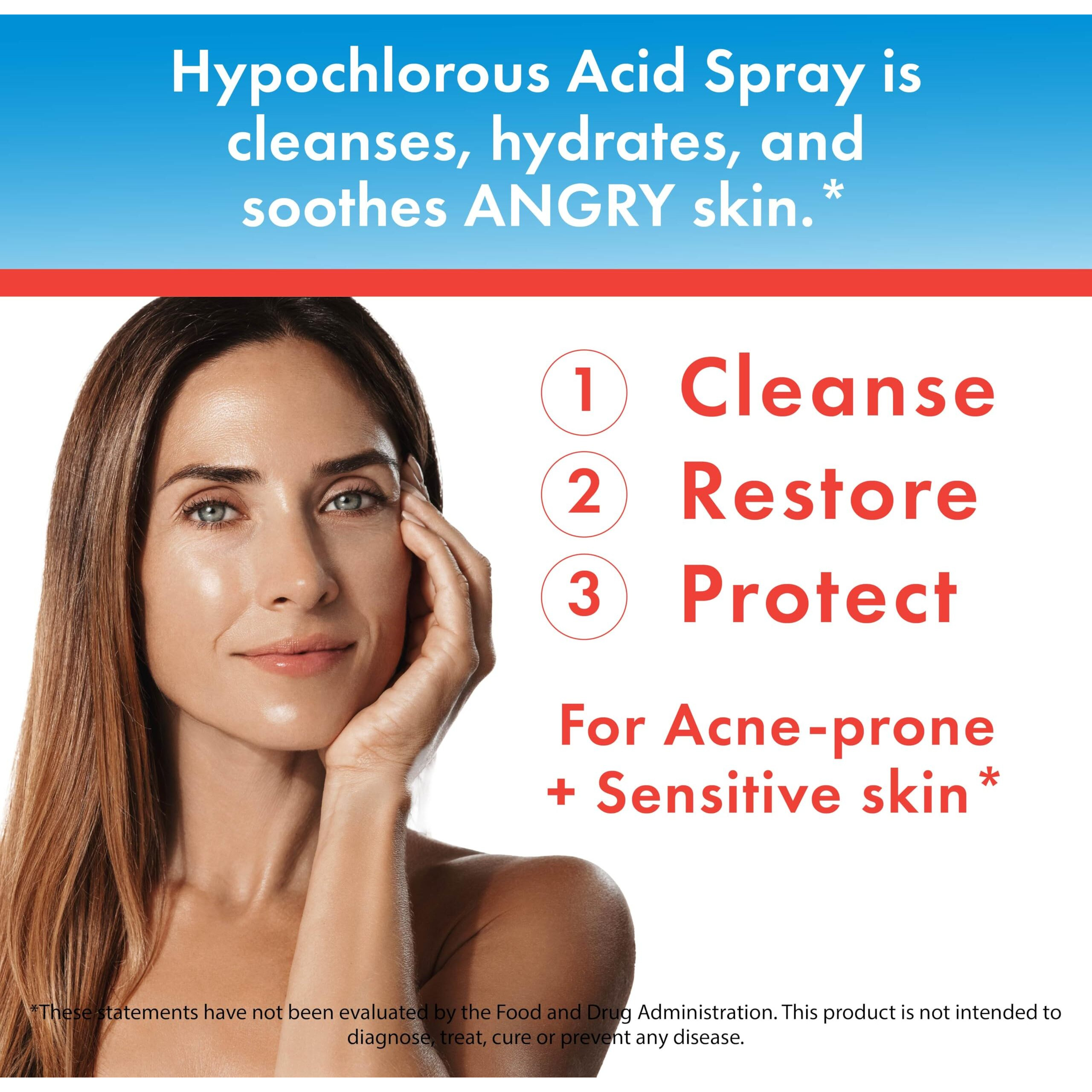 Hypochlorous Acid Spray - Hocl Spray For Face, Body & Eyelids, Gentle Daily Skin Cleanser Safe For Acne-Prone, Red Or Sensitive Skin, Non-Sting, 0.02% Hypochlorous Solution, 8 Oz