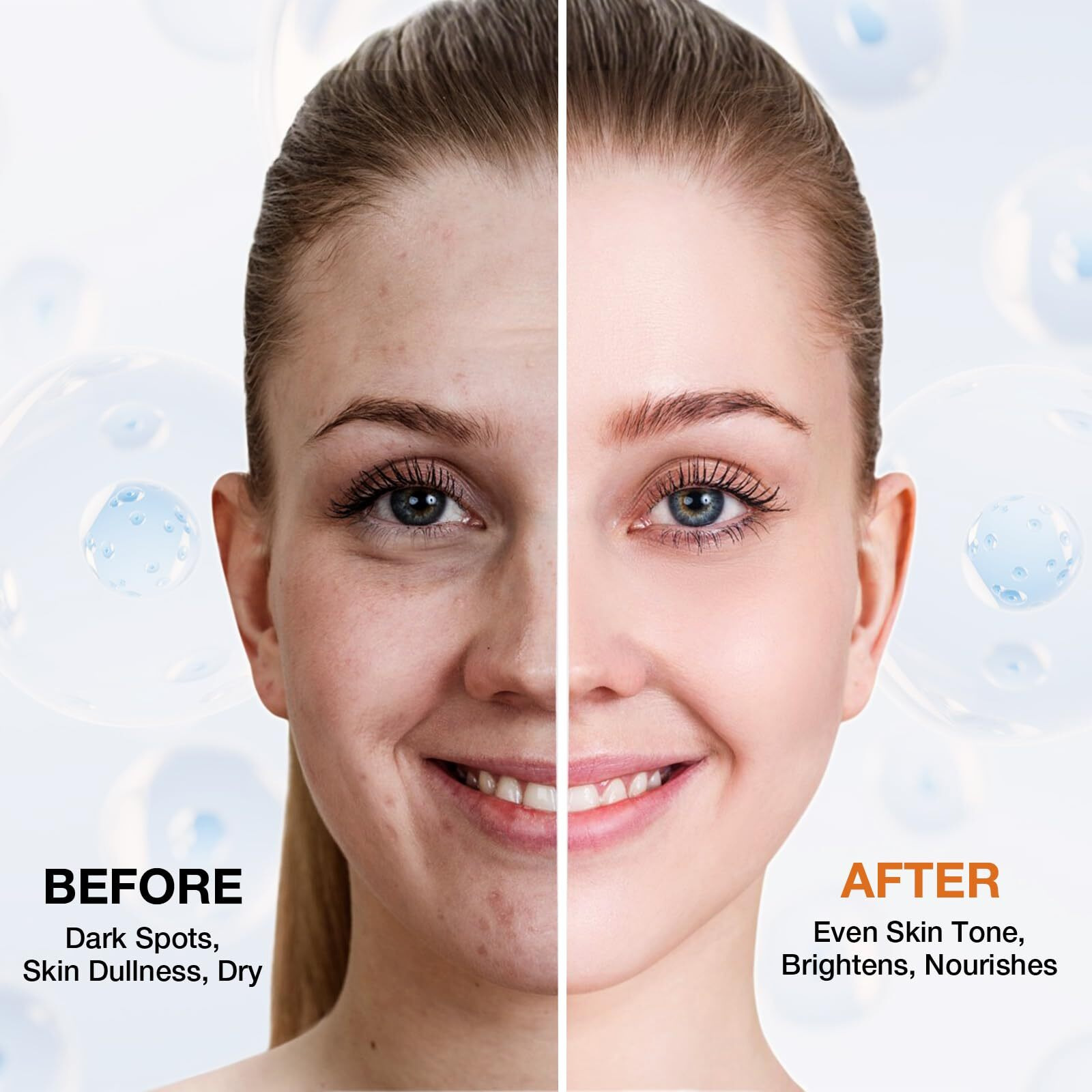 Dark Spot Remover For Face And Body, Dark Spot Corrector Serum, Age Spot Sun Spot Freckles Brown Spot Remover, Skin Care Face Serum With Roller
