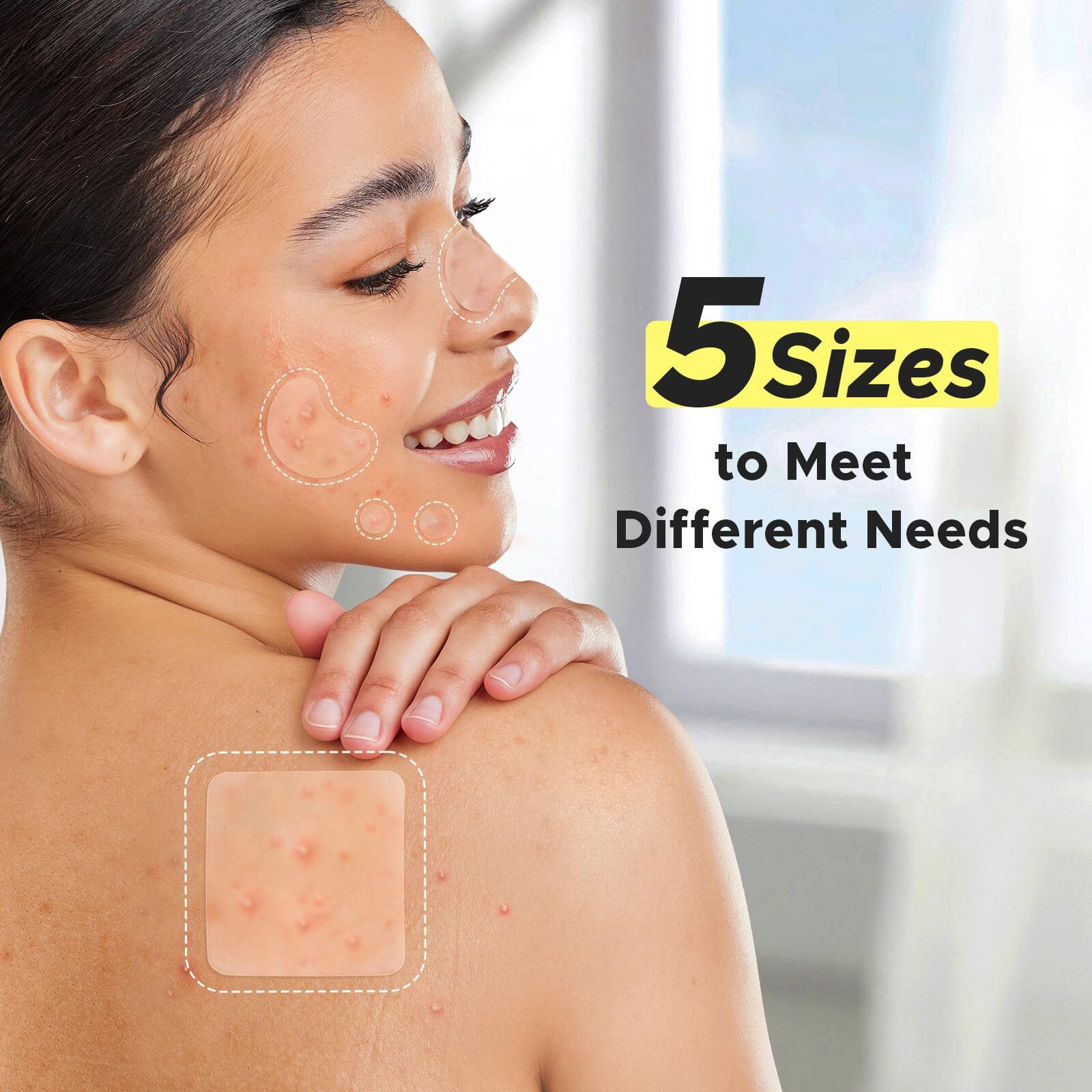 Litbear Pimple Patches For Face, Large Acne Patch, Xl Hydrocolloid Bandages,Zit Stickers For Forehead, Chin, Nose, Body, Back, And Chest (5 Sizes, 228 Pimple Patches)