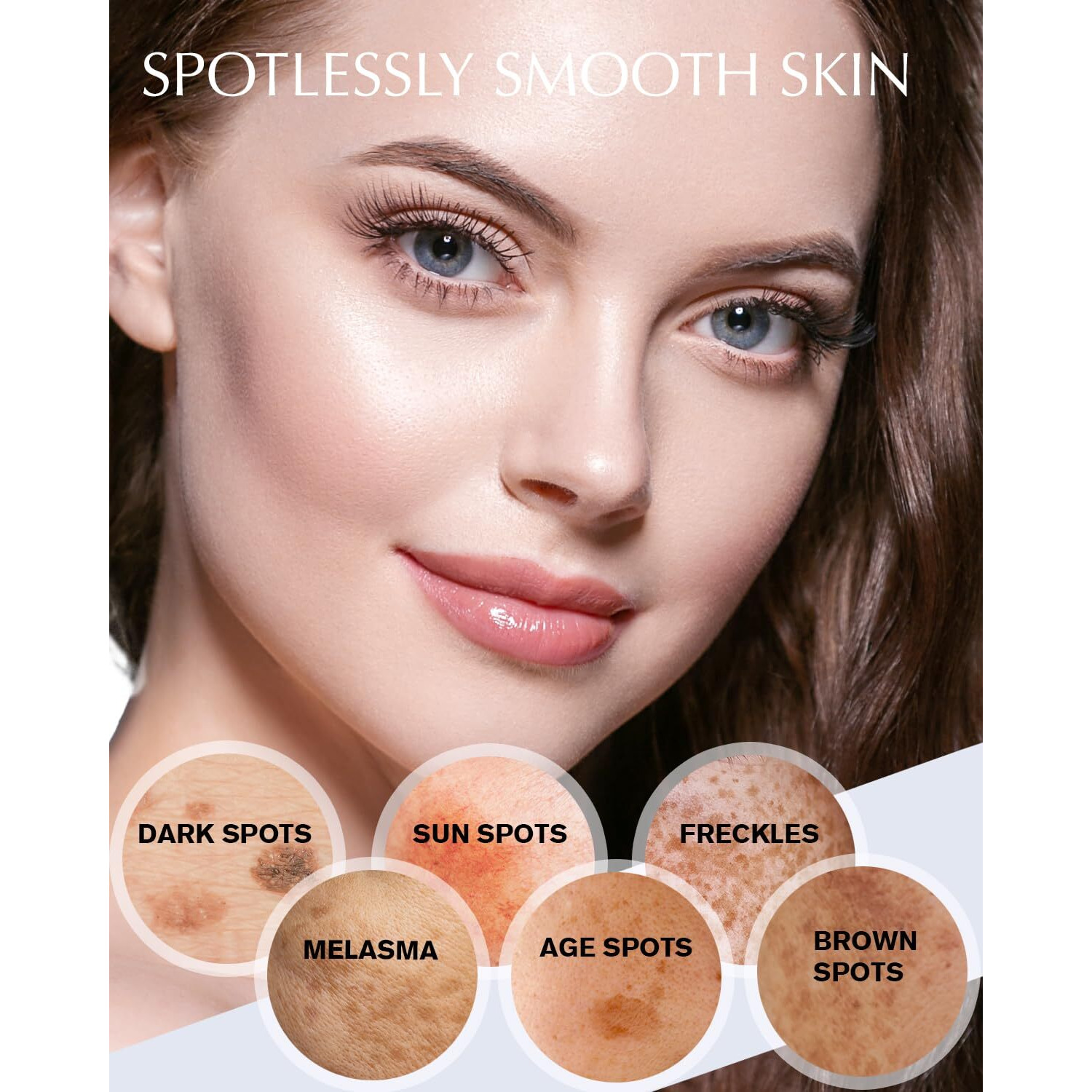 Dark Spot Remover For Face And Body Hyperpigmentation Treatment - Natural Ingredient - Freckle/Melasma/Sun Spot/Age Spot Remover - Dark Spot Corrector Cream For Women And Men
