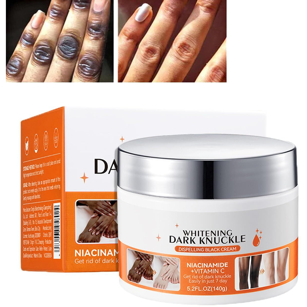 5.2Oz Large Dark Knuckle Whitening Cream,Skin Bleaching For Dark Knees And Elbows,Body Moisturizing Strong Joint Whitening Cream For Clavicle,Neck,Niacinamide Vitamin C Dark Spot Corrector Remover