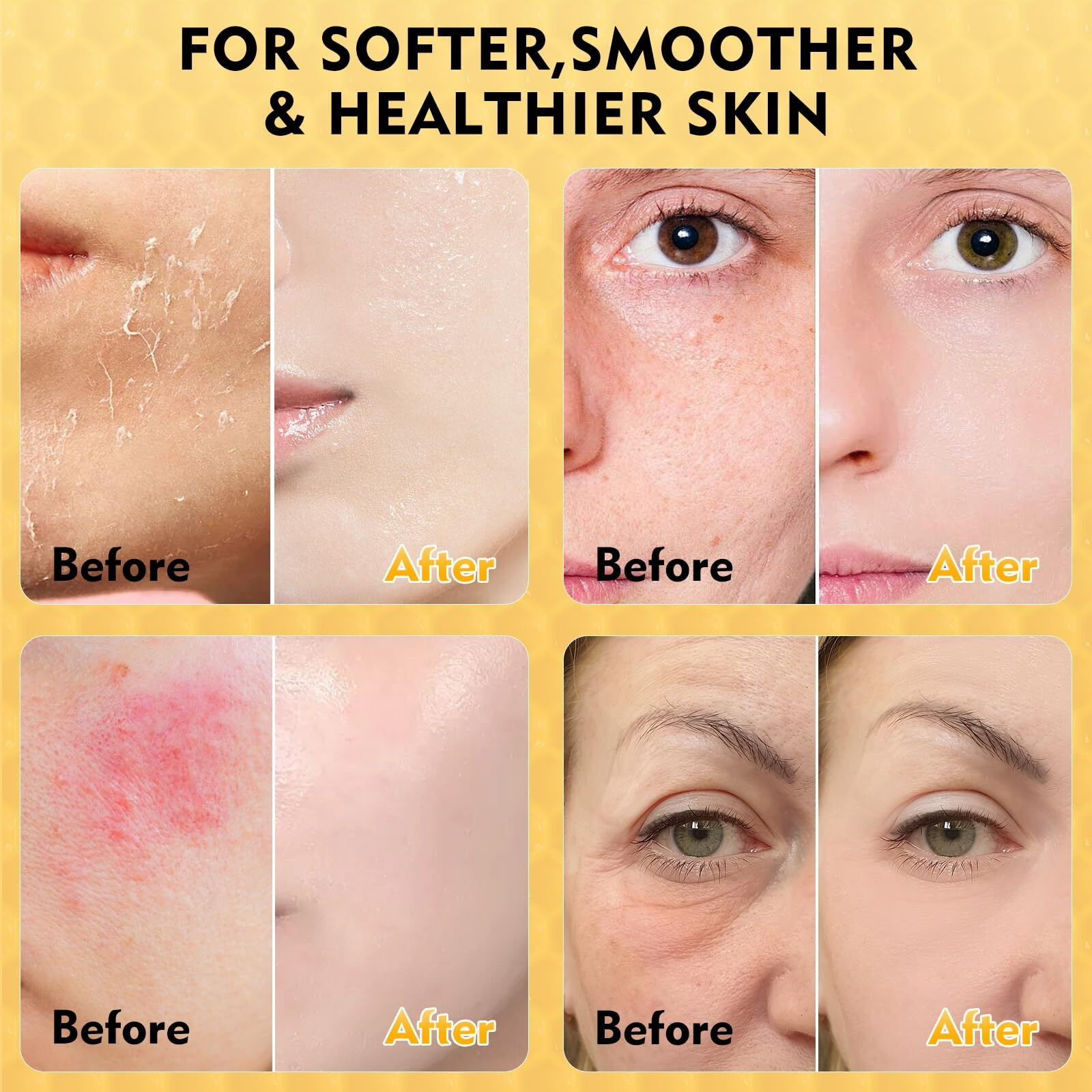 Liventhrall Organic Beef Tallow Honey Balm For Skin, Body & Face Moisturizer, Whipped Grass Fed Cow Tallow Cream With Raw Honey, All Natural Pure Body Lotion For Soft Smooth Skin, Unscented 4.2 Oz