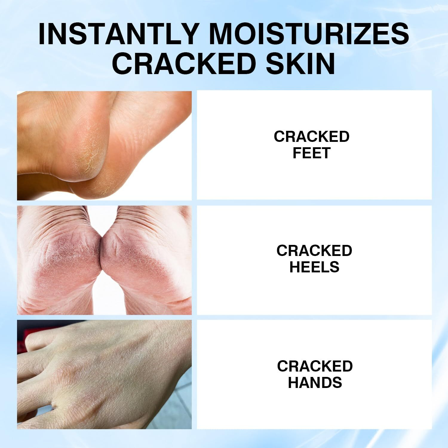 Foot Cream Stick For Dry Cracked Heels,Moisturizing Balm With Salicylic Acid & Olive Oil,Roll-On Repair Treatment For Rough Feet, Hands & Elbows,No Mess Foot Lotion Alternative, 1.05 Oz,1 Pack