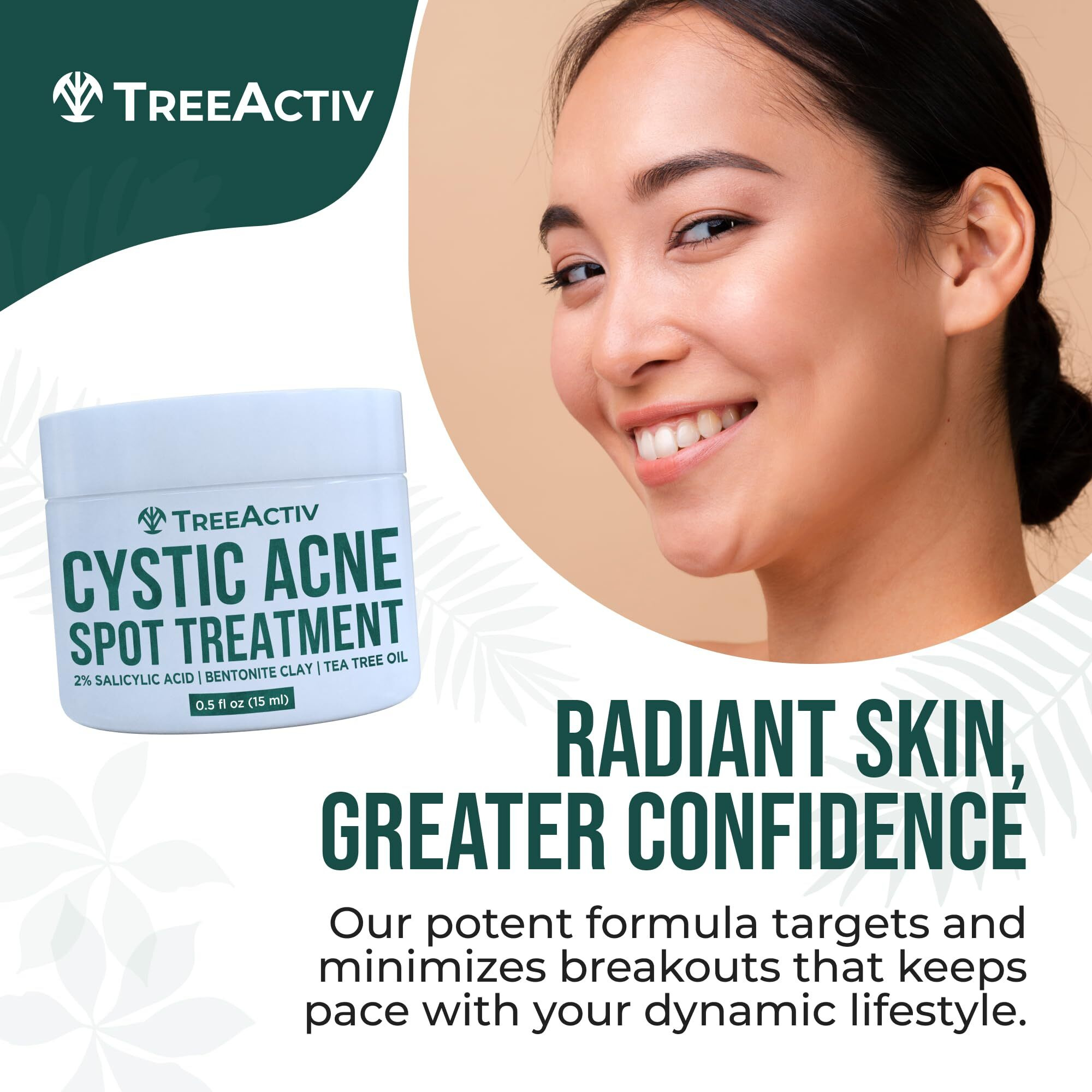 Treeactiv Salicylic Acid Cystic Acne Spot Treatment, 0.5 Fl Oz, For Face And Body, Cream For Hormonal Acne, Teens & Adults