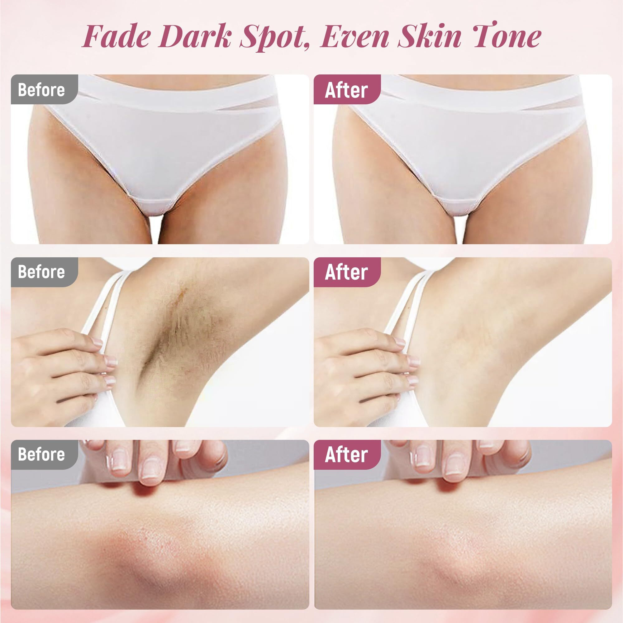 Skin Lightening Cream For Intimate Area Dark Spot Remover Skin Whitening Cream For Sensitive Part Underarms, Inner Thighs, Bikini Line, Knees And Elbows Bleaching Body Cream (1.76 Fl Oz)
