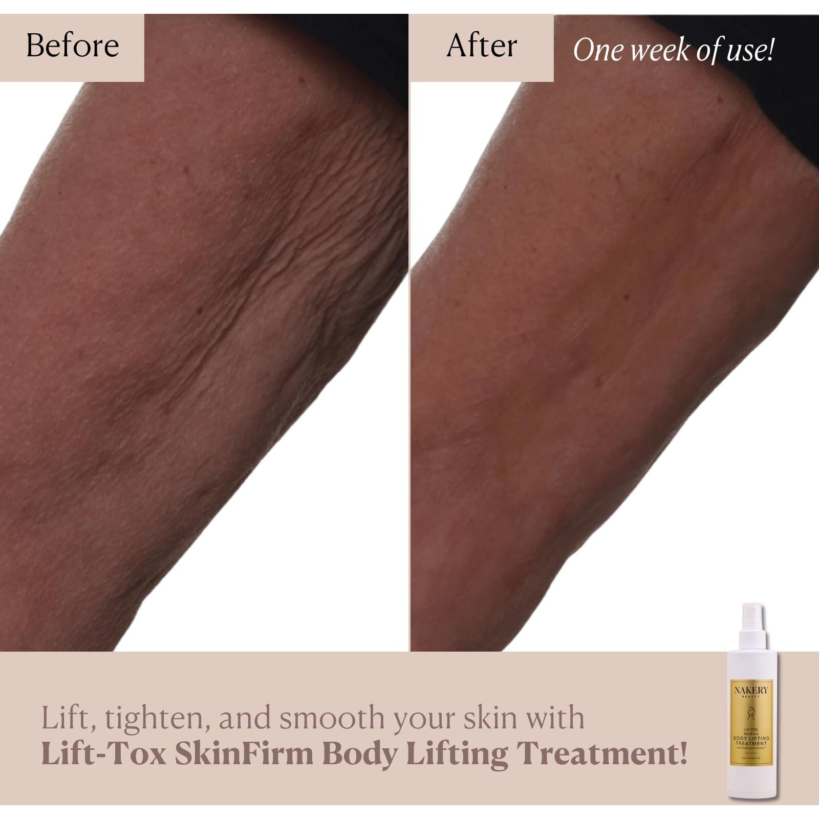 Nakery Lift-Tox Skinfirm Spray, Skin Tightening Cream For Body, Firming Body Lotion Instantly Lifts Saggy Areas & Smooths Cellulite, Crepey Skin Repair, Clinically Proven Body Lifting Treatment