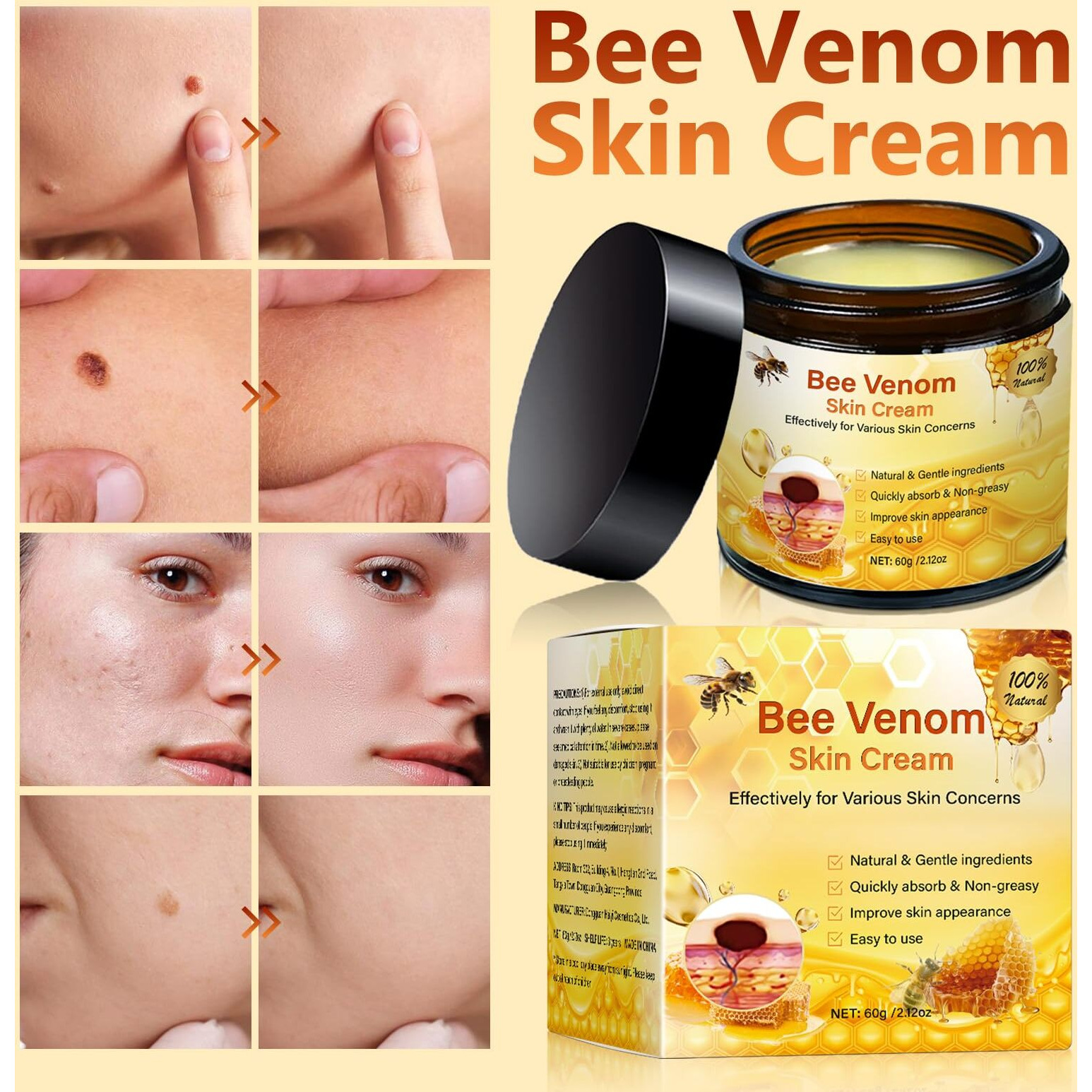 Bee Venom Comprehensive Cream - 2025 Professional Bee Venom Skin Treatmant Cream For Face And Body,Hydrating Natural Skin Restoration Moisturizer For Women Men (2 Bottle)