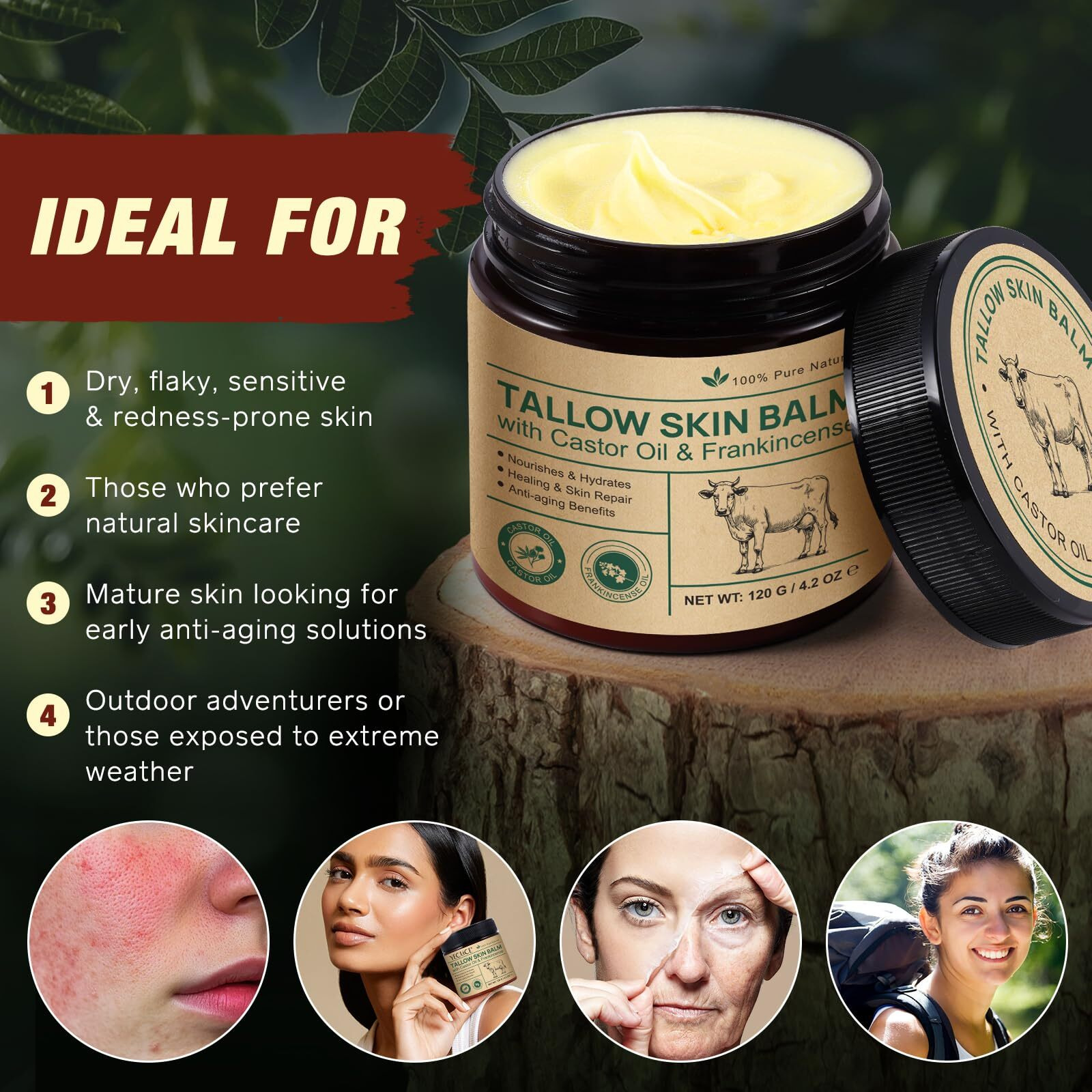 Zixbmhyj Tallow Balm With Castor Oil And Frankincense Skin Balm, Beef Tallow Moisturizer, Frankincense Oil For Skin, 100% Grass-Fed, Nourish & Repairing Dry Skin, Face & Body Cream