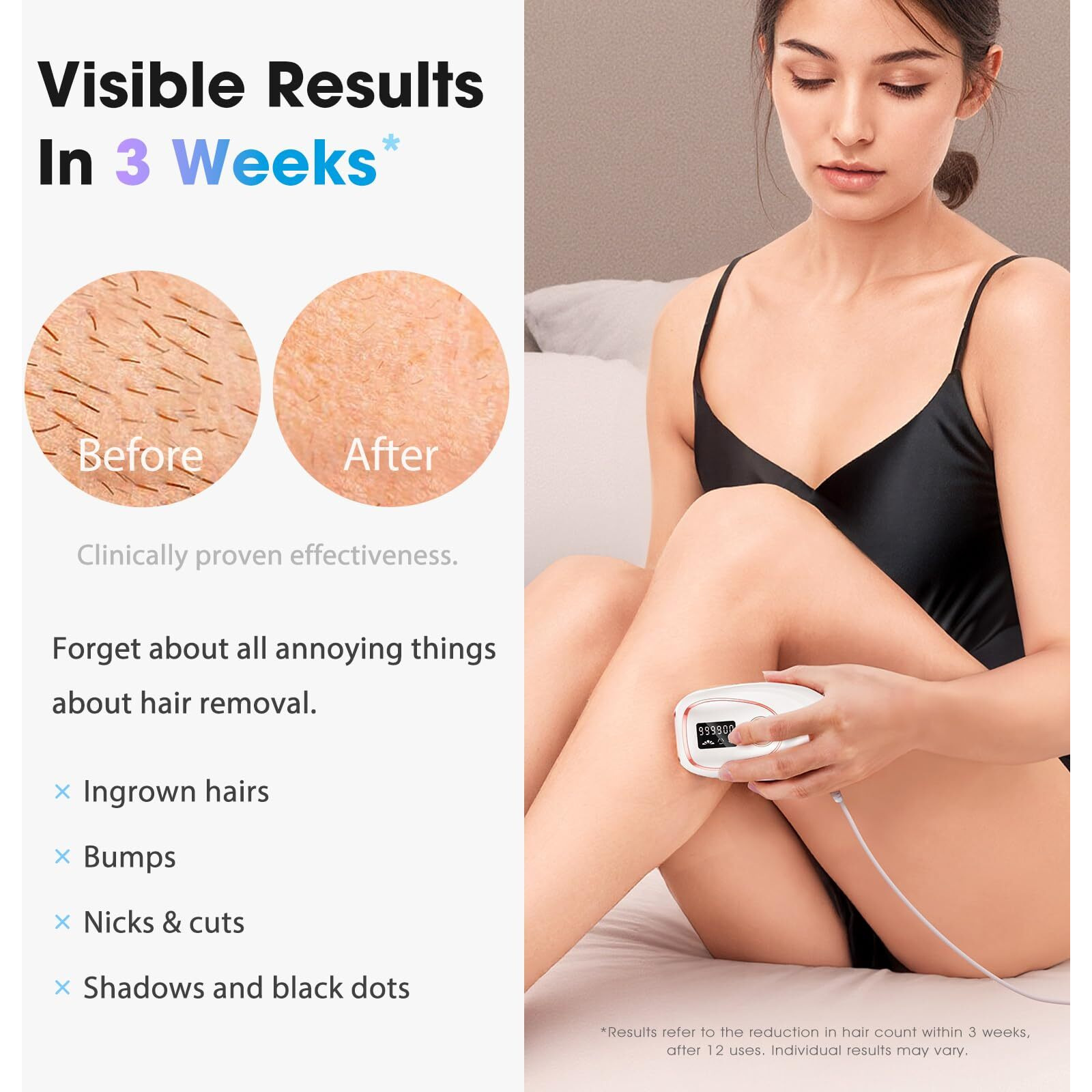 Oreeth Ipl Laser Hair Removal Device For Women & Men - Home 45F Ice-Cooling Contact For Painless & Long-Lasting Results, 86% Hair Reduction In 3 Weeks For Full Body & Bikini Line, White