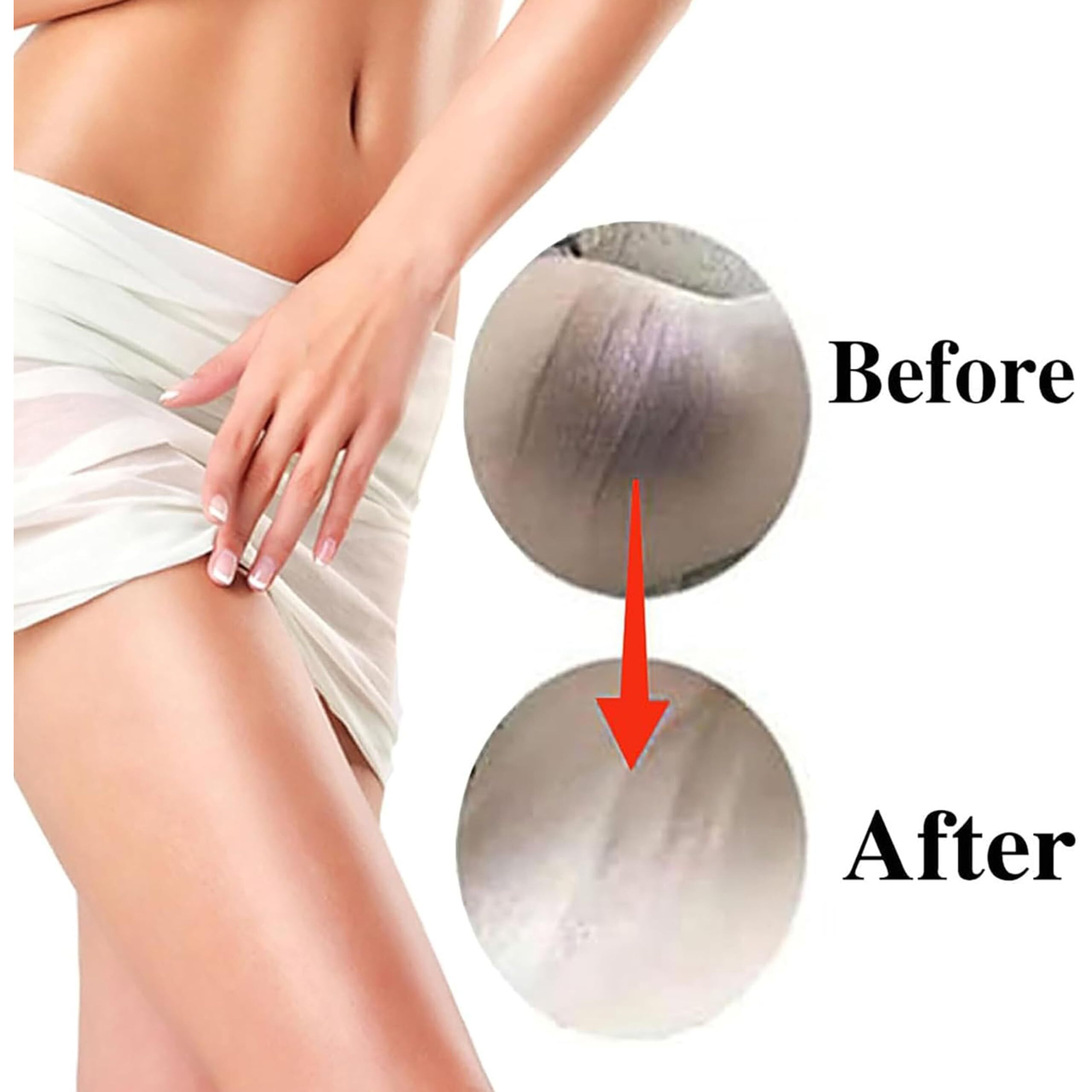 Intimate Areas Skin Lightening Cream For Private Parts, Underarm, Intimate Area, Bikini Area, Inner Thighs, Knees, Elbows, Bleach Skin Bleaching Whitening Cream For Body (1.06 Fl Oz)