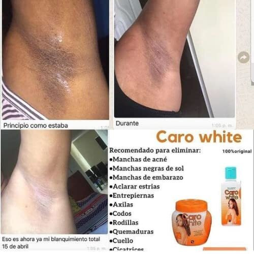 Caro White Set-3 (Lotion 10.14Oz + Cream 10.14Oz + Soap 6.3Oz)