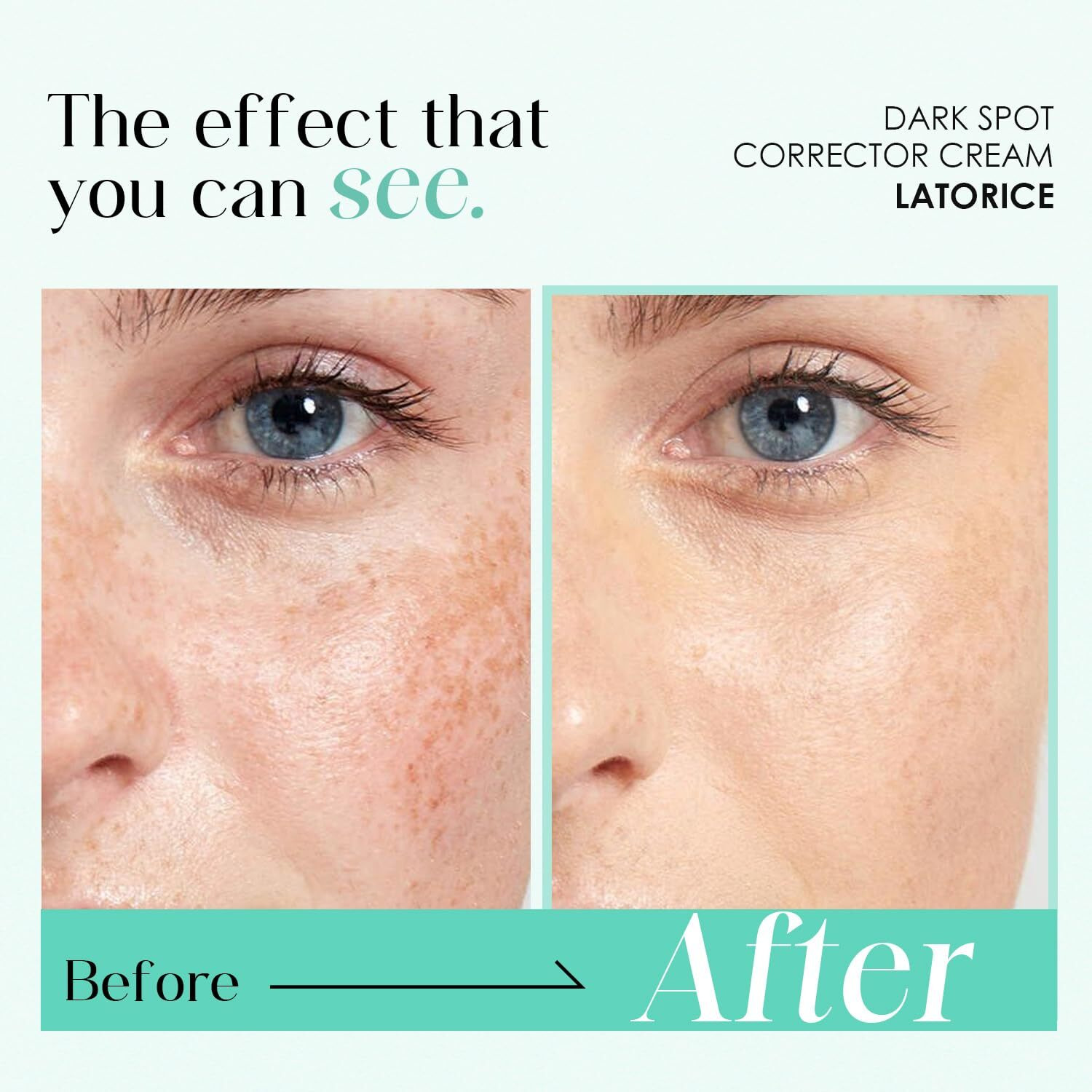 Dark Spot Remover For Face & Body Reduce Hyperpigmentation Sun Spots Acne Scars - Natural Ingredient Enriching Skin Care For Men & Women With Dry Skin - Intensive Hydration -1.7 Fl Oz