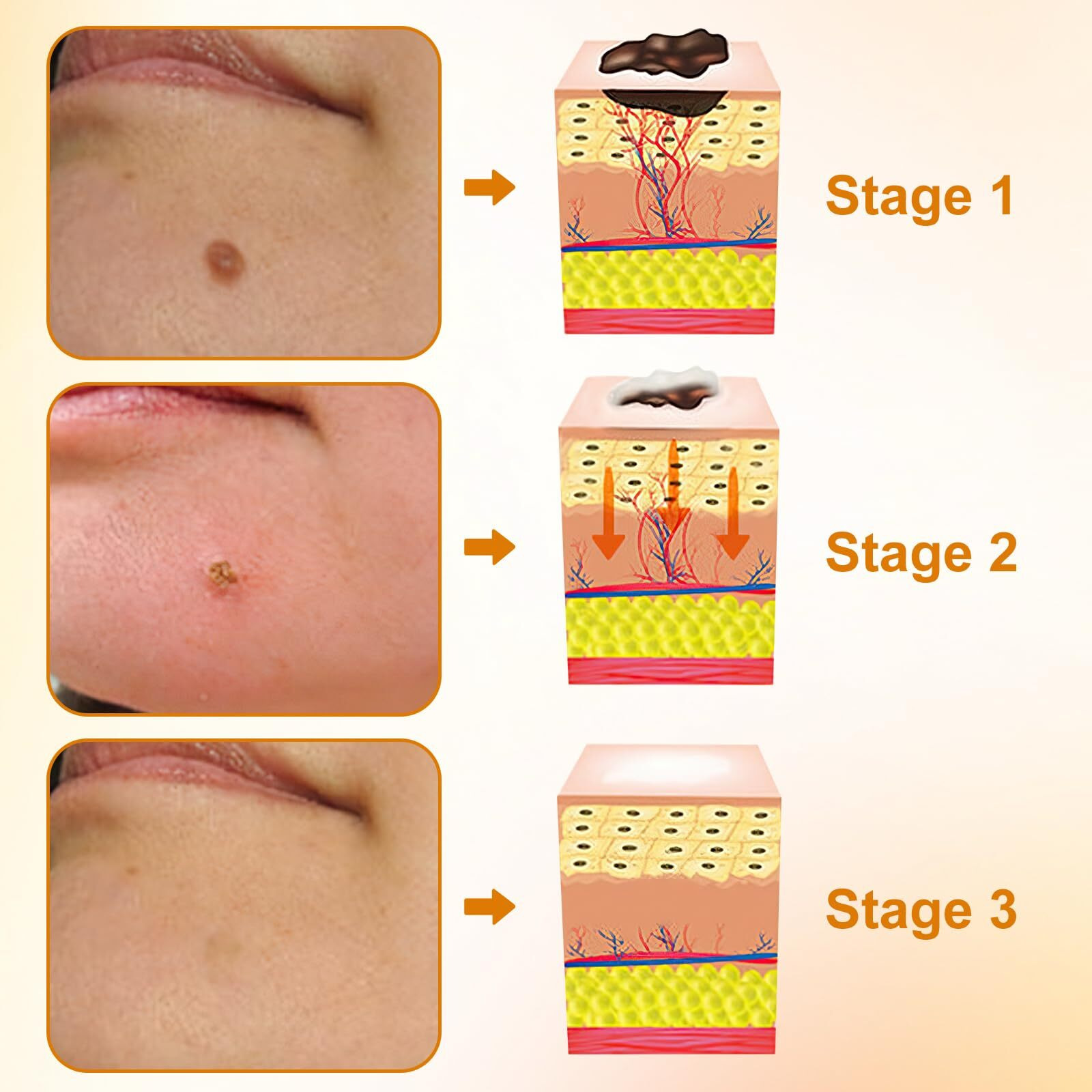 Viuvoiul 2 Bottle Bee Venom All-In-One Cream, Bee Venom Skin Treatmentcream, Beevenom Skin Repair Cream For Face And Body, Repair, Moisturize And Lift 3 In 1, For Allskin Types