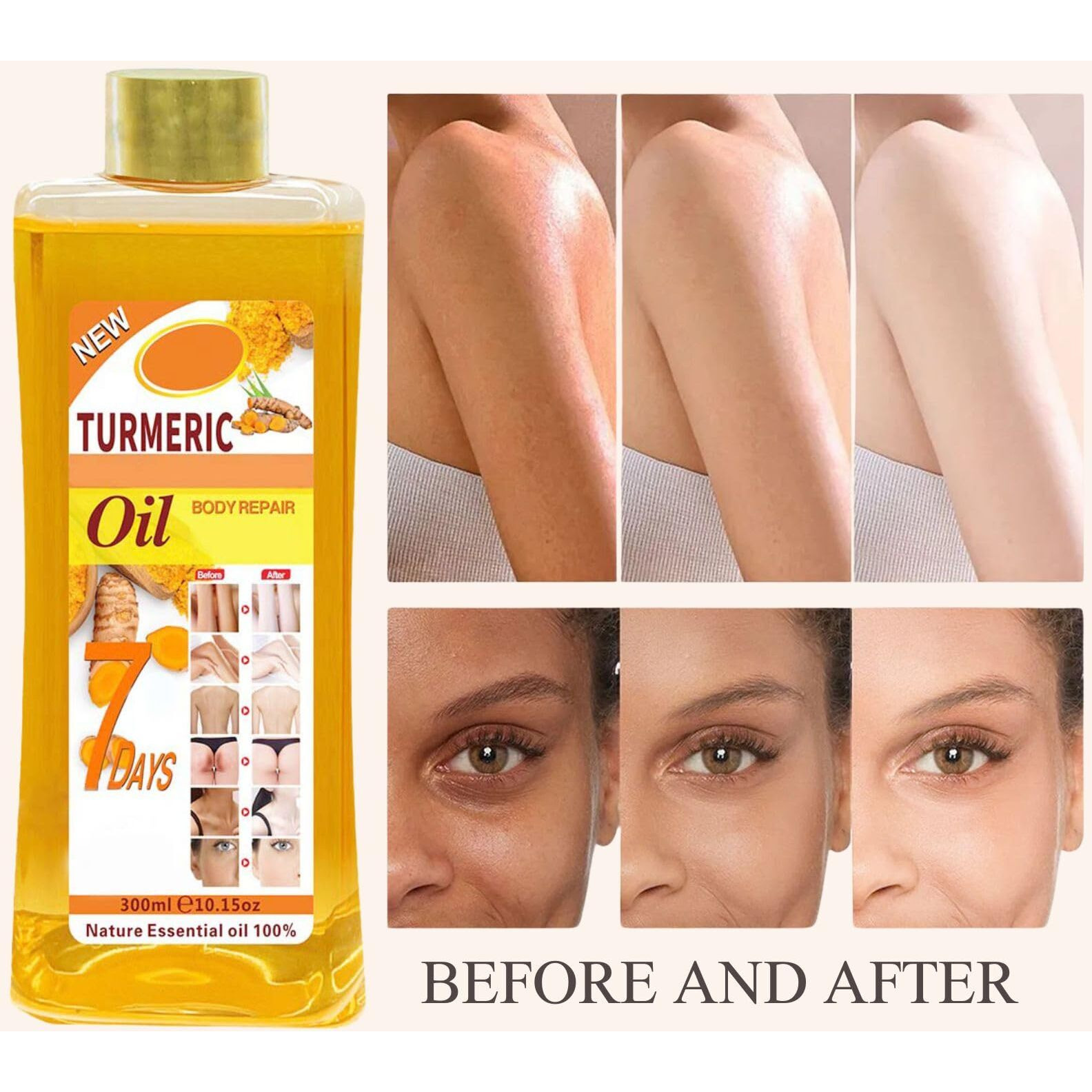 Miledy Soft 7 Oil, Soft 7 Turmeric Oil For Skin, S Oft 7 Turmeric O Il, Moisturizing Face And Body, Suitable All Skin Types