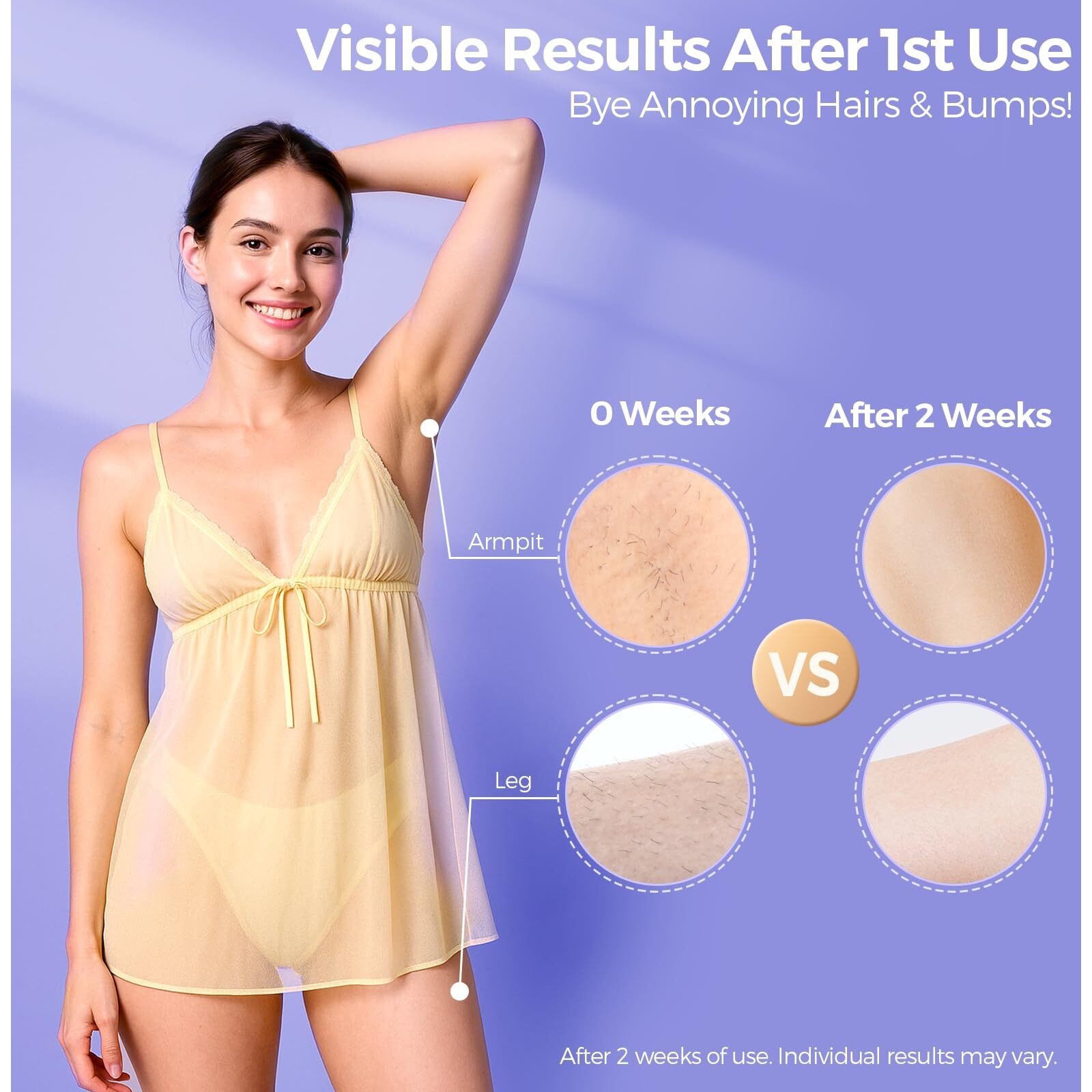 Laser Hair Removal With 5 Ice Cooling, Painless Ipl Laser Hair Removal Device For Women & Men, 999,999 Flashes, 5 Levels, 2 Modes, Permanent At-Home Hair Removal For Face & Body, With 3 In 1 Set