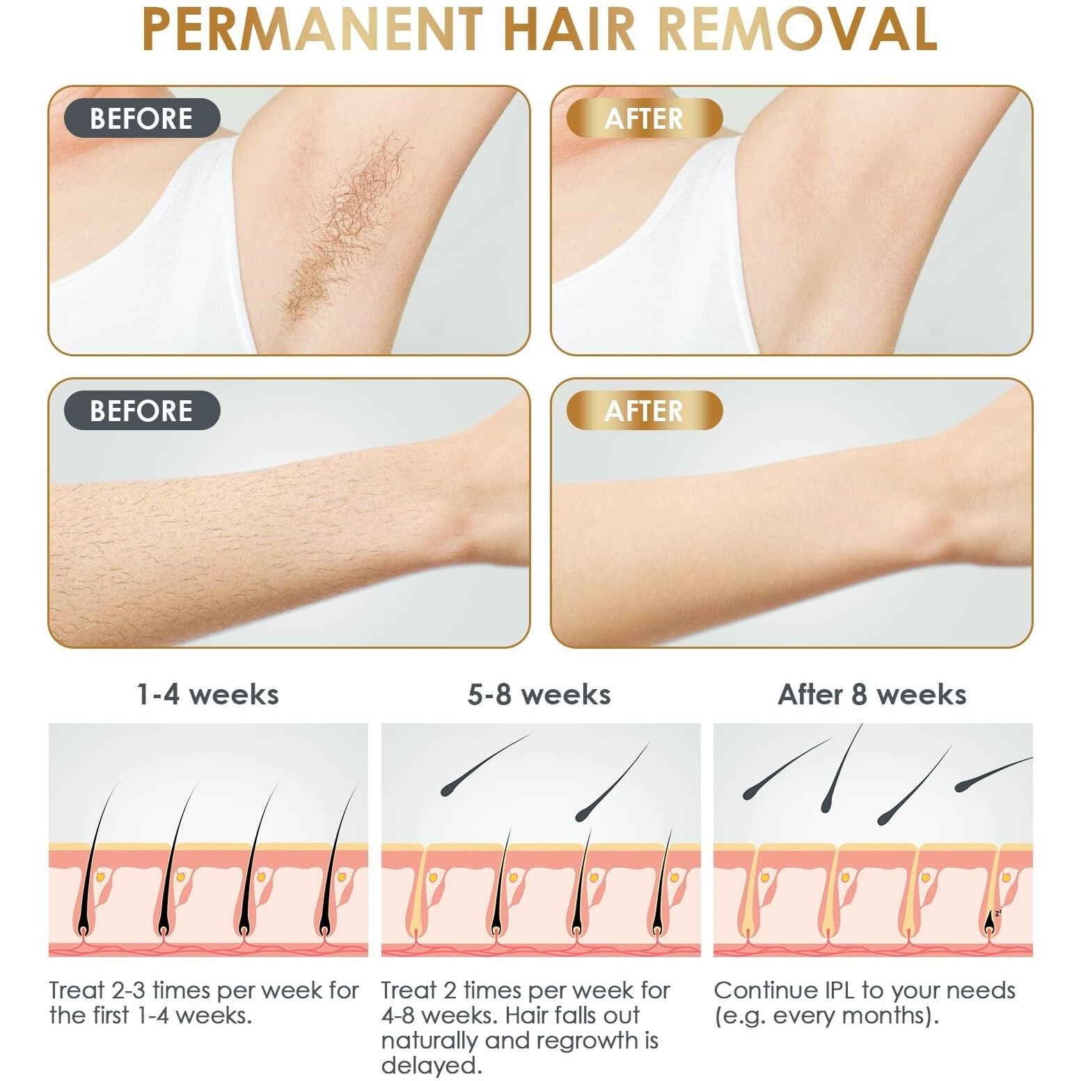 Ipl Laser Hair Removal Device At-Home For Women Men Natrsym Painless Permanent Facial Upper Lip Bikini Line Armpits Back Legs Arms Face Back Whole Body Remover