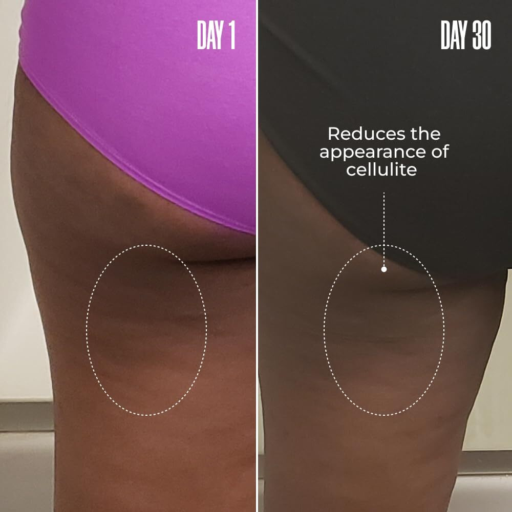 Malys Re-Lure Tight & Tone Body Serum - Hyaluronic Acid Serum For Women - Hydrating, Tightens Appearance Of Skin For Toned Look