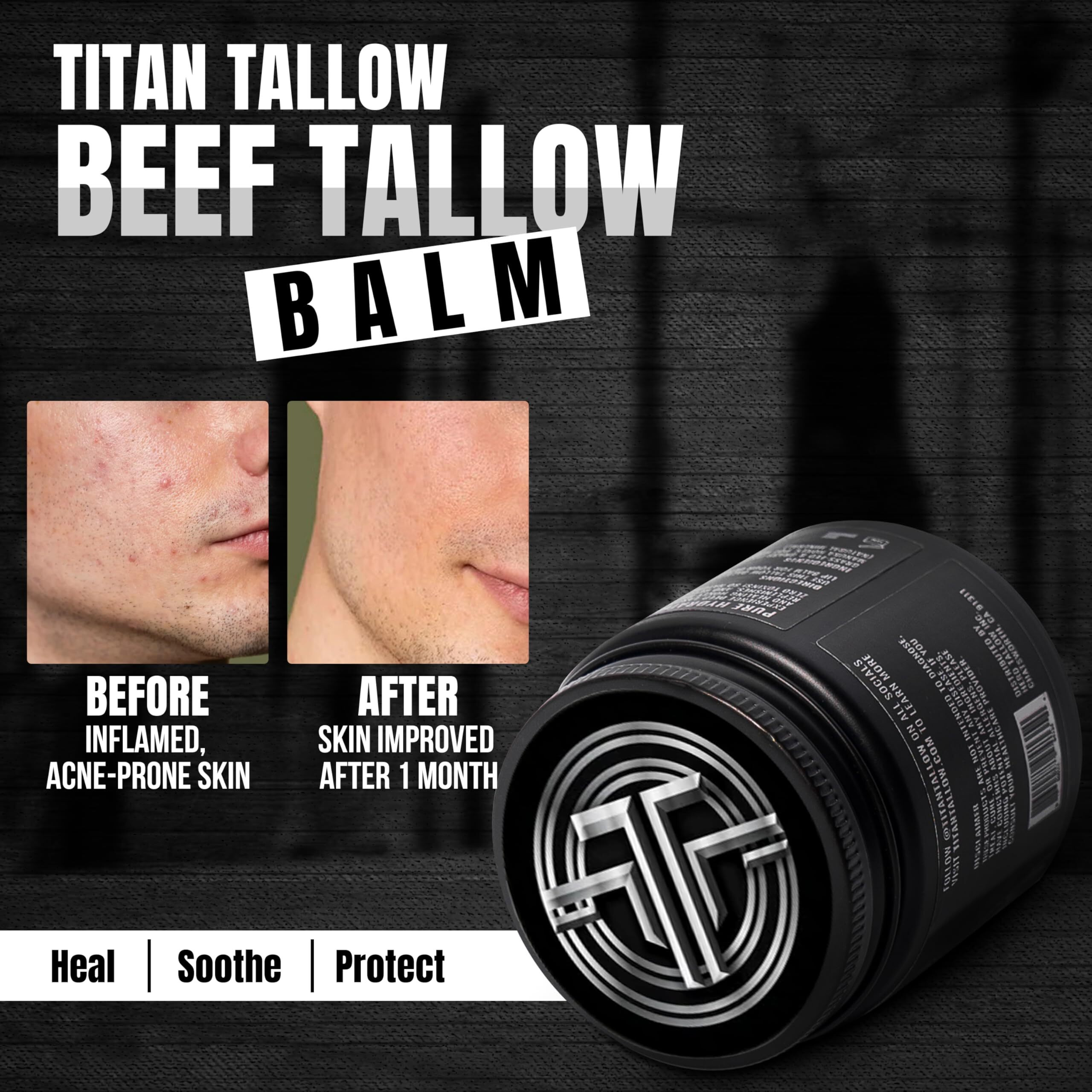 Whipped Beef Tallow Balm Magnesium Moisturizer - 100% Organic Grass-Fed & Grass-Finished Tallow With Manuka Honey For Skin Care - Face & Body Lotion For Dry, Irritated, Or Sensitive Skin - 4 Oz