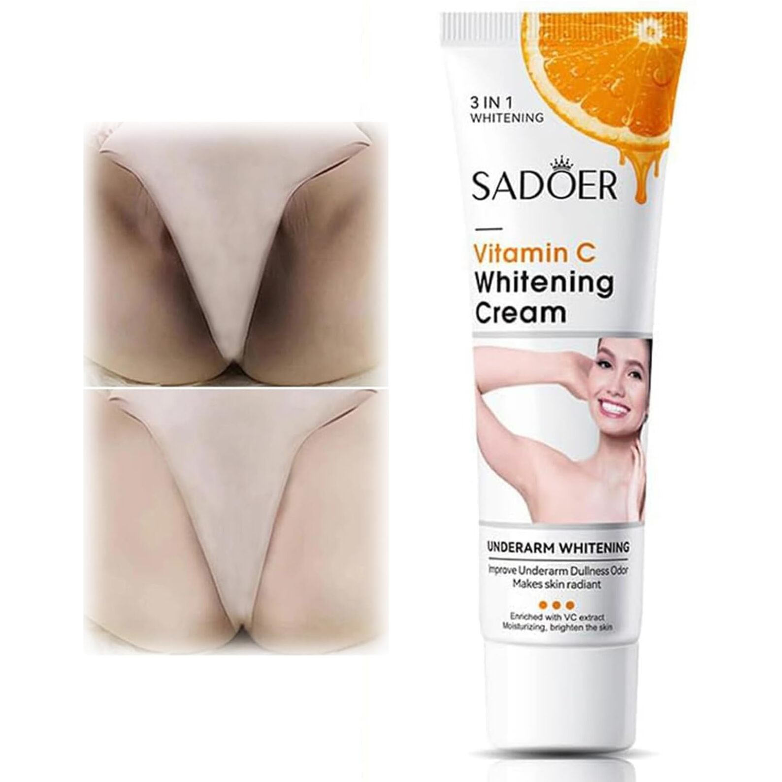 Skin Whitening Cream For Body, Dark Spot Remover Corrector For Intimate Areas, Bleaching And Bikini Area, Vitamin C Lightening Cream