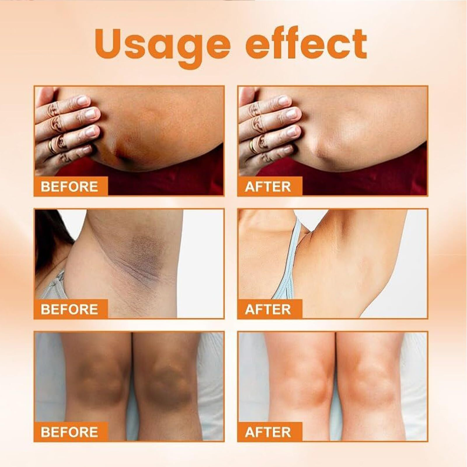 Skin Whitening Cream For Body, Dark Spot Remover Corrector For Intimate Areas, Bleaching And Bikini Area, Vitamin C Lightening Cream