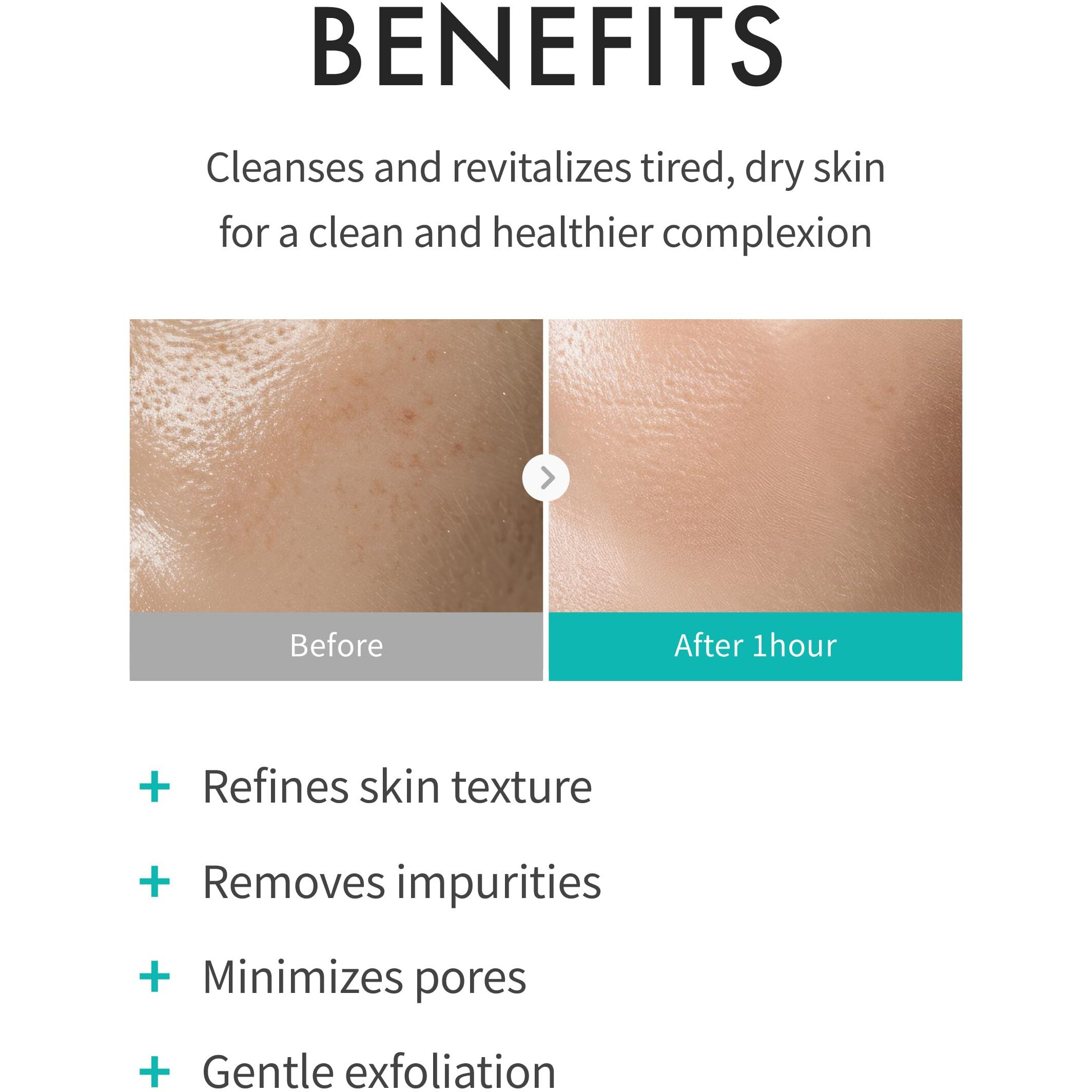 Rejuran Refining Foam Cleanser, C-Pdrn - Hydrating & Gentle For Smoother, Clearer Skin, Minimizes Pores & Balances With Hyaluronic Acid & Tanin Complex, Korean Skin Care (4.05 Fl Oz)