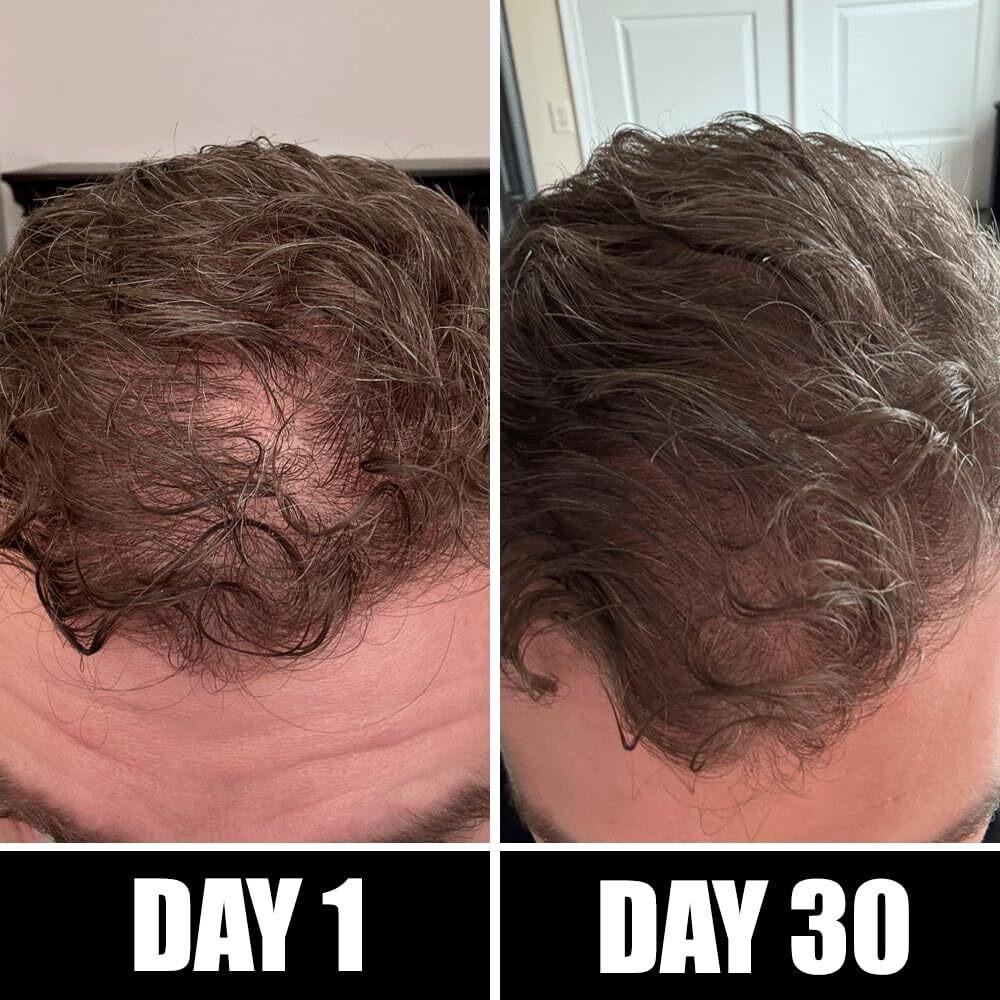 Pete & Pedro Boost Hair & Beard Growth Serum Strengthening Oil For Men & Women - With Rosemary, Biotin & 20+ Natural Essential Oils | Shark Tank Featured, 2 Oz.