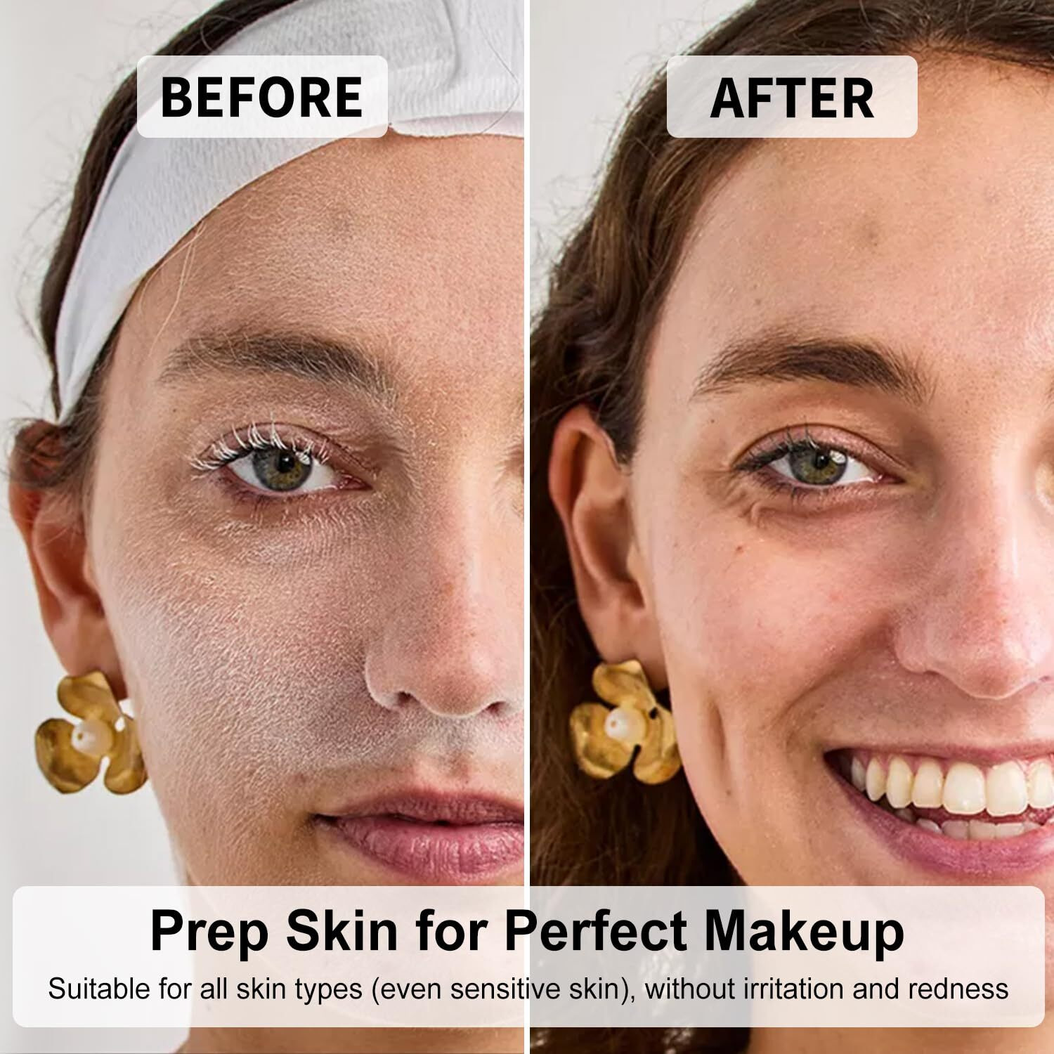 Face Razors For Women, Dermaplane Razor For Women Face, Eyebrow Razor, Dermaplaning And Skin Care Tool, Gentle Exfoliation Microblades For Facial Hair Removal, Perfectly Shape Brows, 10 Pcs (Lilac)