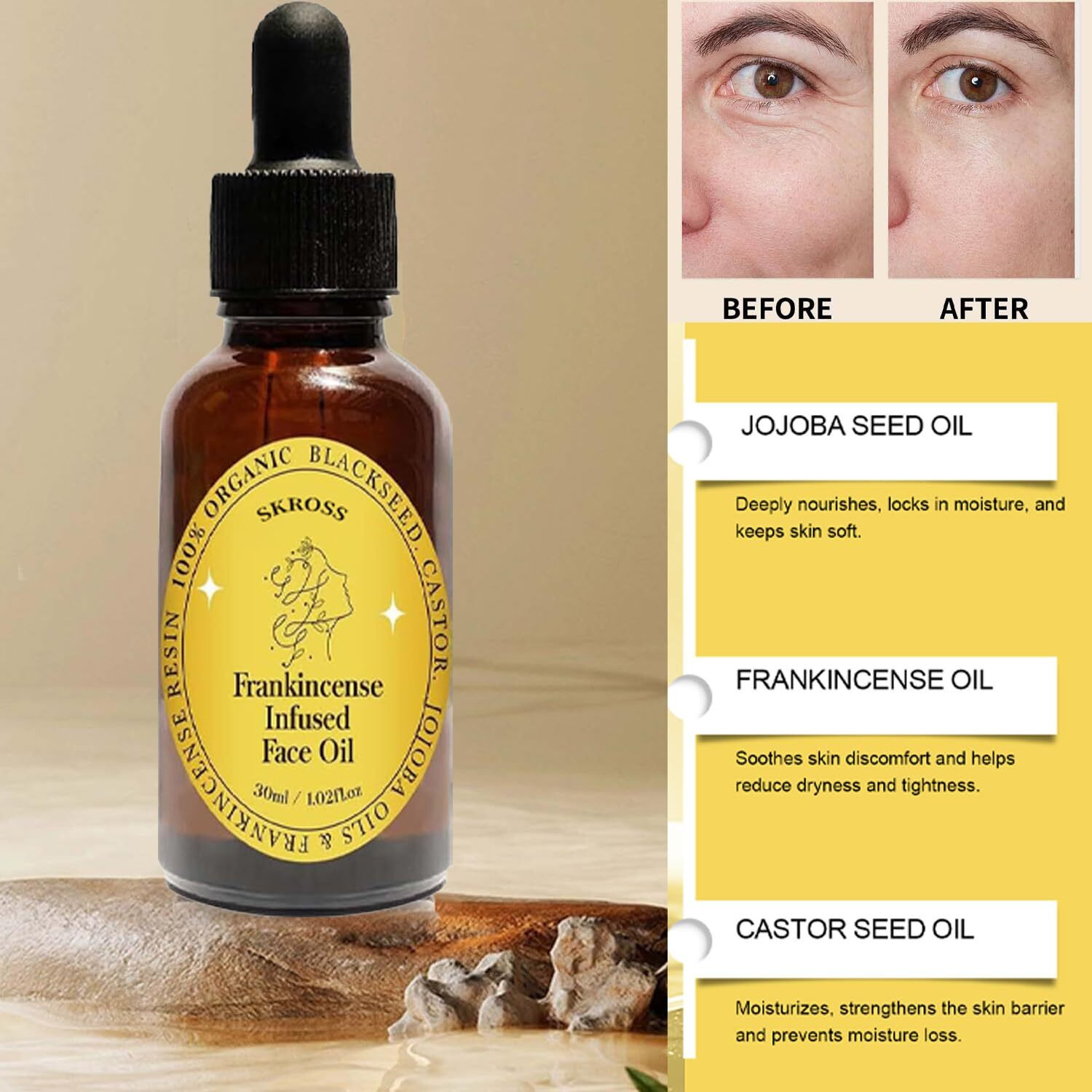 2Pcs Frankincense Resin Oil, Frankincense Infused Face Oil, Infused With Organic Black Seed, Castor, And Jojoba Oil, Facial Moisturizing Anti-Aging Serum