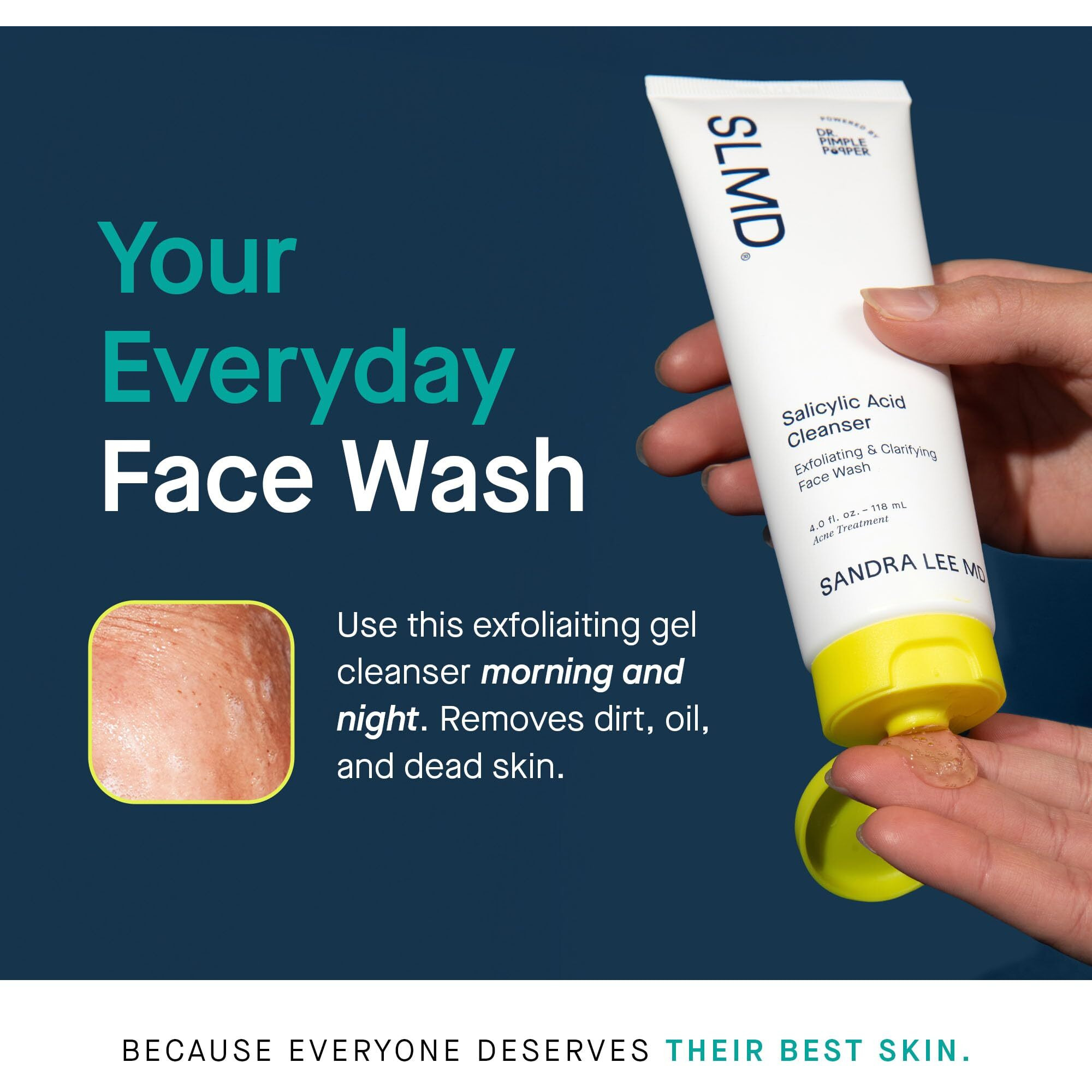 Slmd By Dr. Pimple Popper - Salicylic Acid Cleanser 4 Fl Oz Exfoliating Gel Cleanser Face Wash Acne-Prone Skin - Face Wash Helps Reduce The Appearance Of Blackheads & Whiteheads