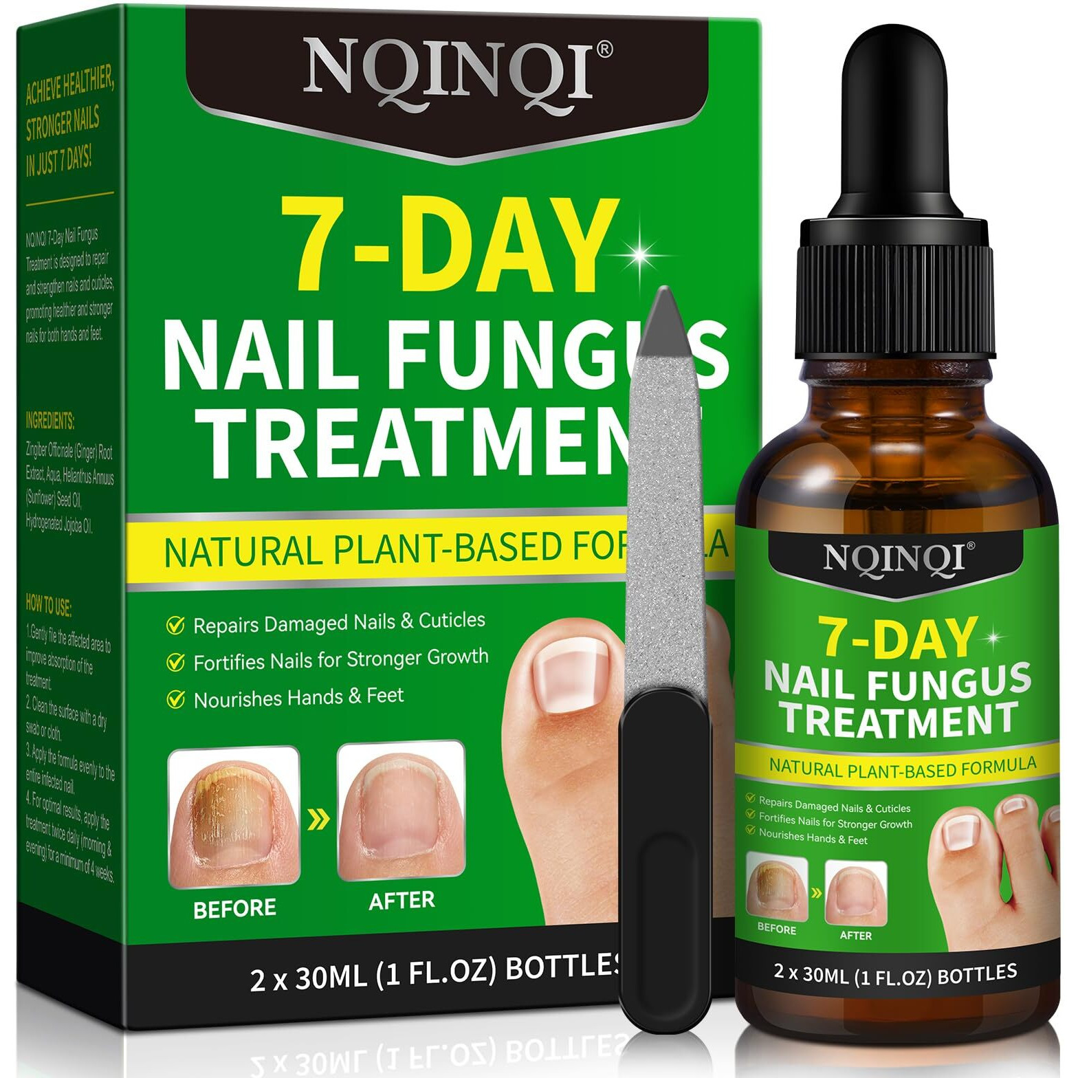 Nqinqi 7 Days Nail Fungus Treatment, Fungi Nail Liquid Maximum Strength, Ginger Cuticle Care Oil For Strengthen & Promote Nail Growth (2Pcs)