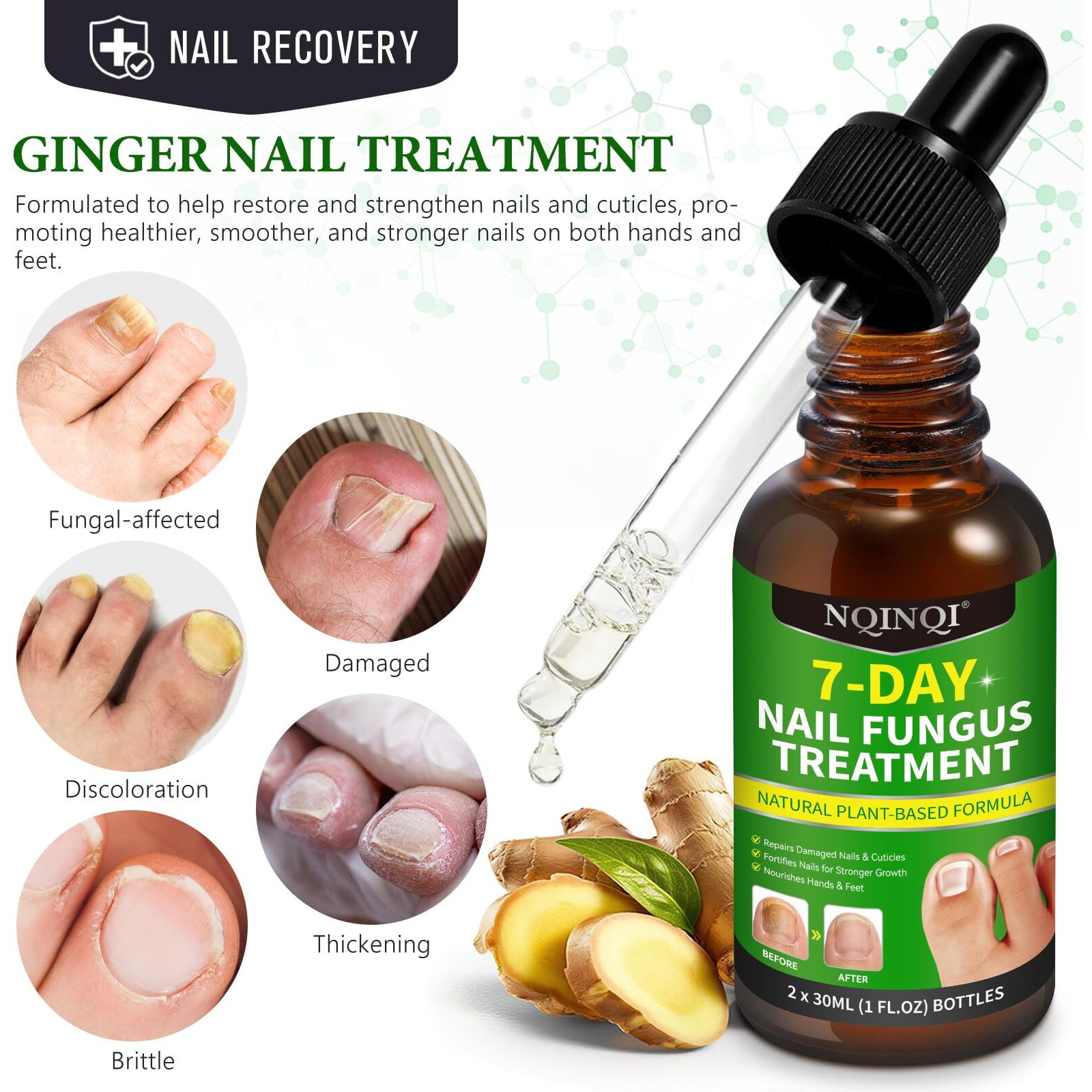 Nqinqi 7 Days Nail Fungus Treatment, Fungi Nail Liquid Maximum Strength, Ginger Cuticle Care Oil For Strengthen & Promote Nail Growth (2Pcs)