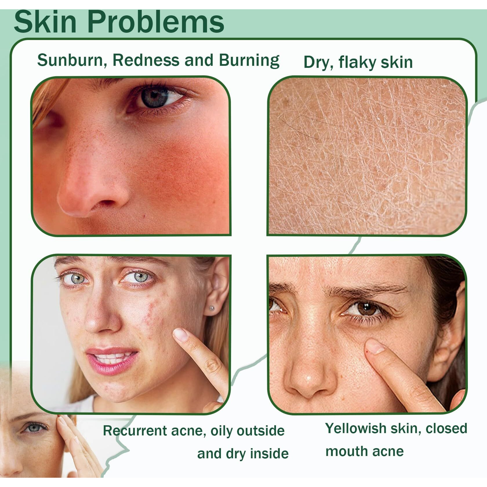 Moisturizing Gel For Face & Body,Non-Sticky Gel After Sun Aloe Lotion Skin Care,Fast Absorbing Long Lasting Refreshing Hydrating Face Moisturizer For All Skin Types 04