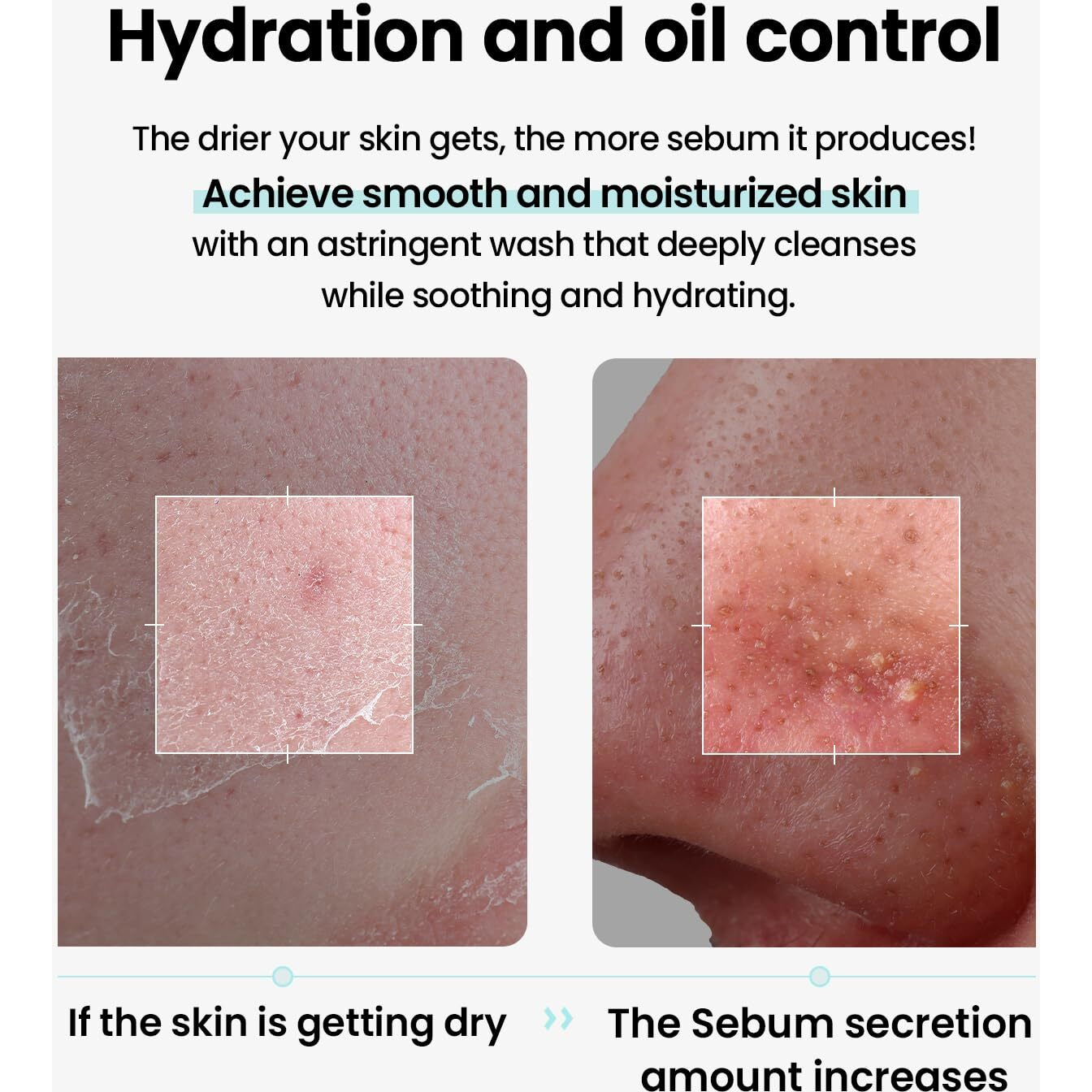 Ilso Super Melting Sebum Cleansing Oil, Watery Oil Type, Sensitive Skin Face Wash, Oil Cleanser For Face, Makeup Blackhead Remover, Korean Skin Care 6.75 Fl Oz (200Ml)