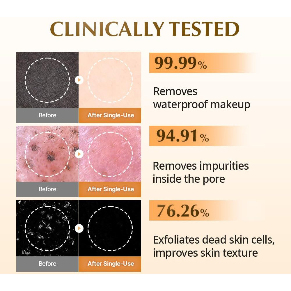 Uiq Biome Barrier Firming Collagen Cleansing Balm | Hygenic One-Step Makeup Remover | Non-Greasy Sorbet Texture | Gentle, Soothing For All Skin Types | No.1 Oliveyoung Cleanser | 3.38 Fl. Oz.