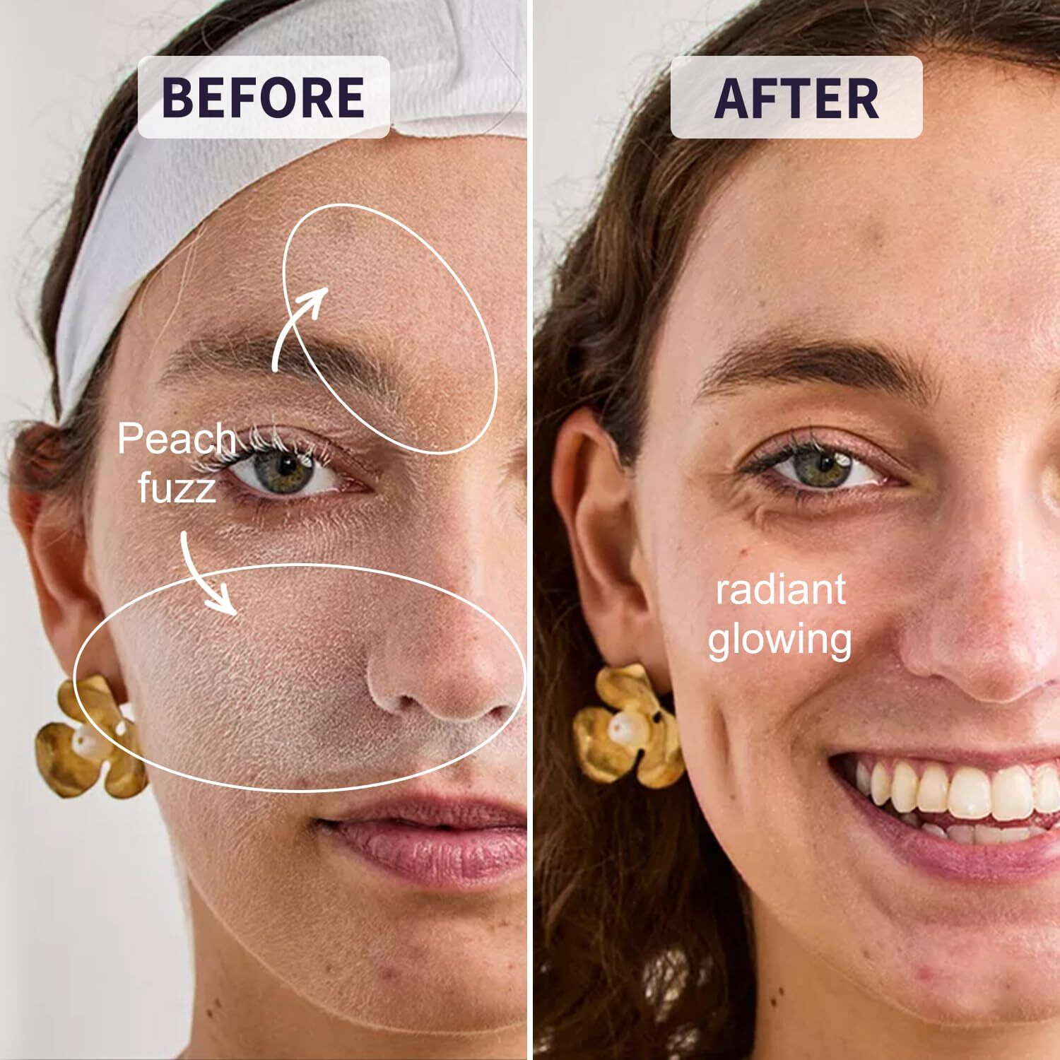 Thurlady Face Razors For Women, Reusable Handle With 19 Microblades, Dermaplane Razor For Women Face, Eyebrow & Facial Razors, Peach Fuzz Remover, Gentle Exfoliating, For Sensitive Skin (Solar Veil)