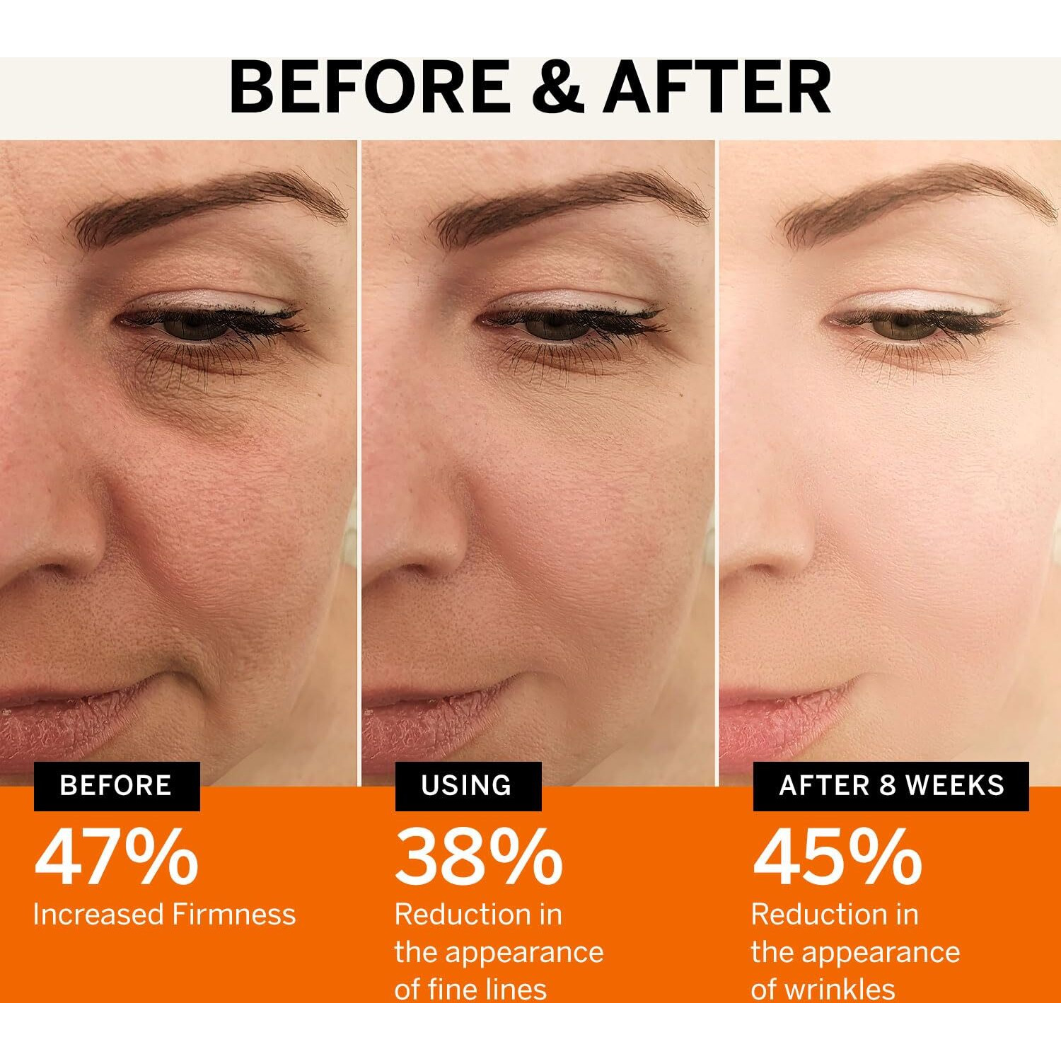 Lupure Vitamin C Face Serum Anti Aging Super Vit C Facial Serum With Ferulic Acid Pure L-Ascorbic Acid, Vitamin E And Hyaluronic Acid For Dark Spots And Skin Care